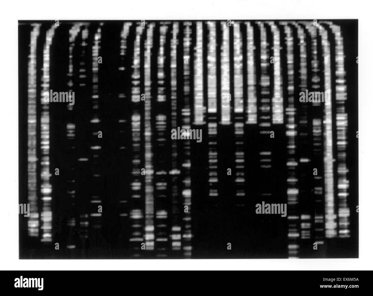 Grafico di DNA, 1998 dalle forze armate USA Istituto di Patologia Foto Stock