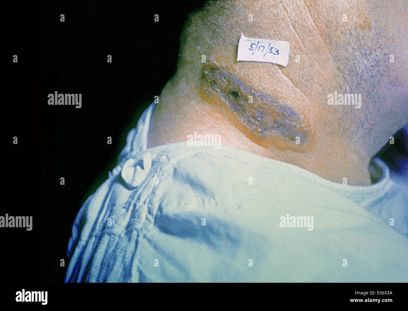 sul collo dell'uomo Foto Stock