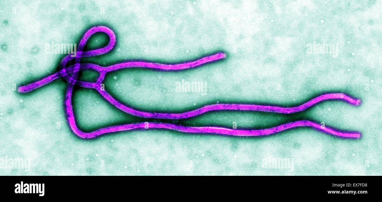 Microscopio elettronico a trasmissione (TEM) di un virus Ebola virione. Foto Stock