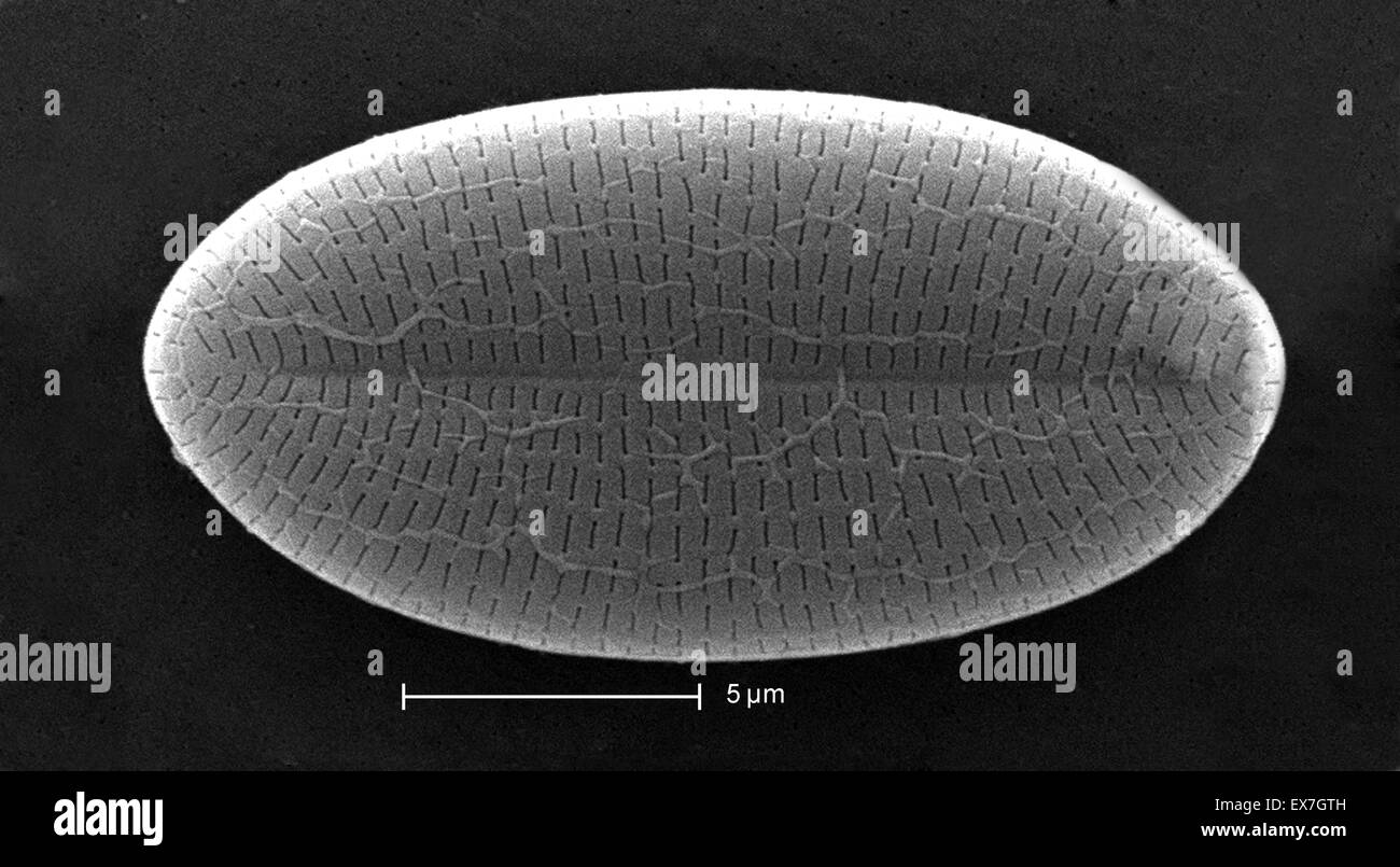 Micrografia al microscopio elettronico a scansione che mostra una diatomea Foto Stock