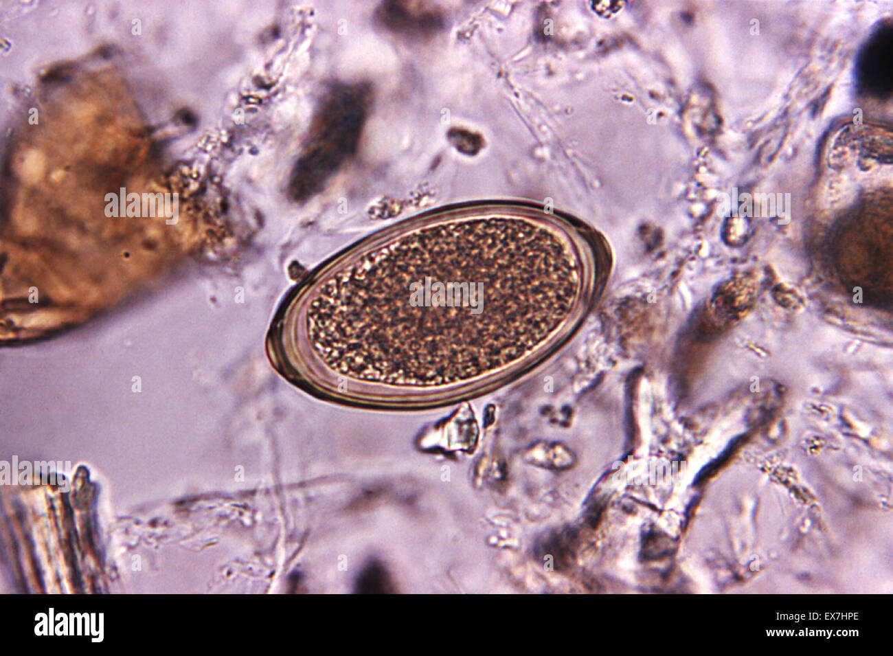 La fotomicrografia di parassiti whipworm uovo, Trichuris vulpis. Foto Stock