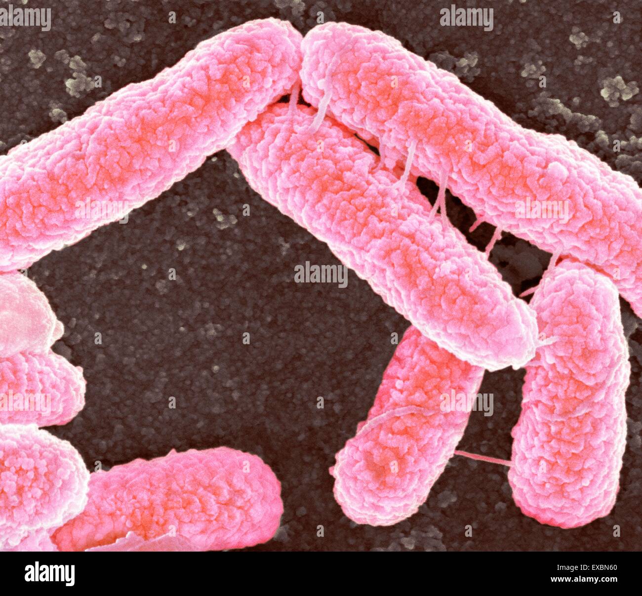 Color scanning electron microfotografia (SEM) di batteri Escherichia coli. I tubi che collegano i batteri sono pili, che sono Foto Stock