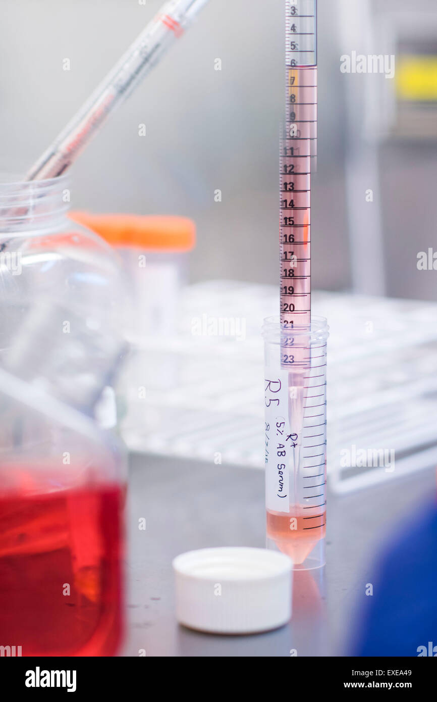 Test di farmaci per la cura del cancro in un laboratorio di analisi mediche Foto Stock