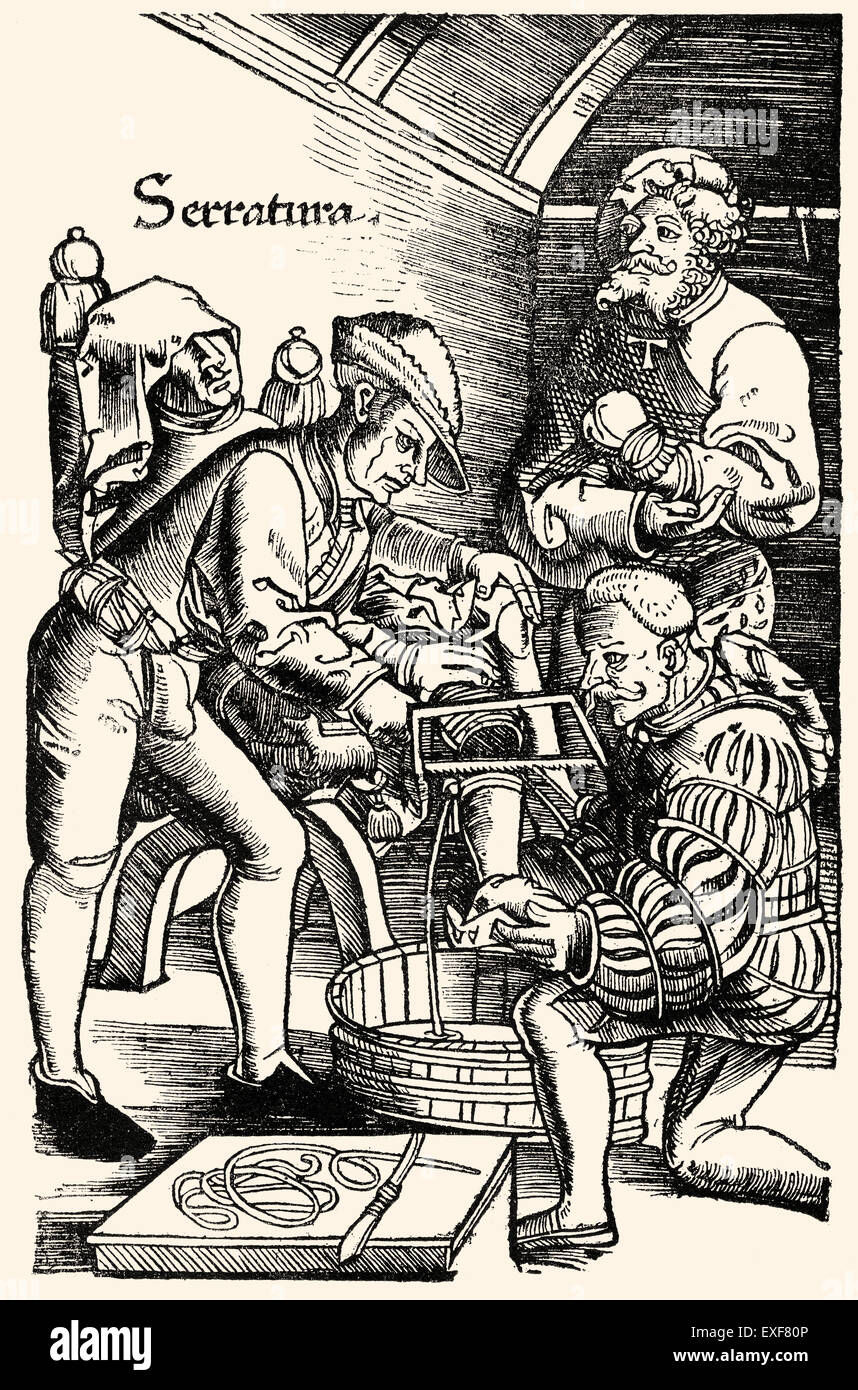 Chirurgo tedesco, amputazione della gamba senza anestesia, Hans van Gersdorff, 1528 'Feldtbuch der Wundartzney' (campo libro di surg Foto Stock