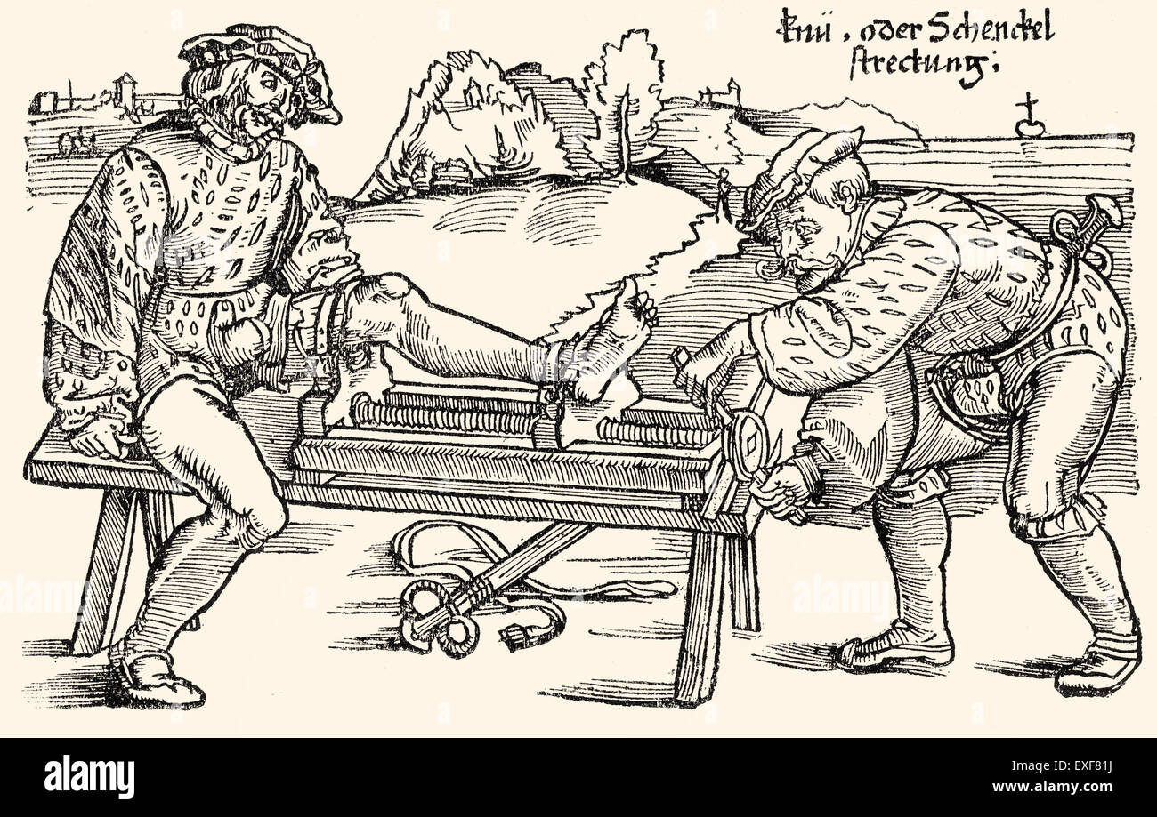 Estensione delle gambe su un rack di stiro, terapia ortopedica, xilografia da 'Feldtbuch der Wundartzney' da Hans von Gersdorff, 1528 Foto Stock