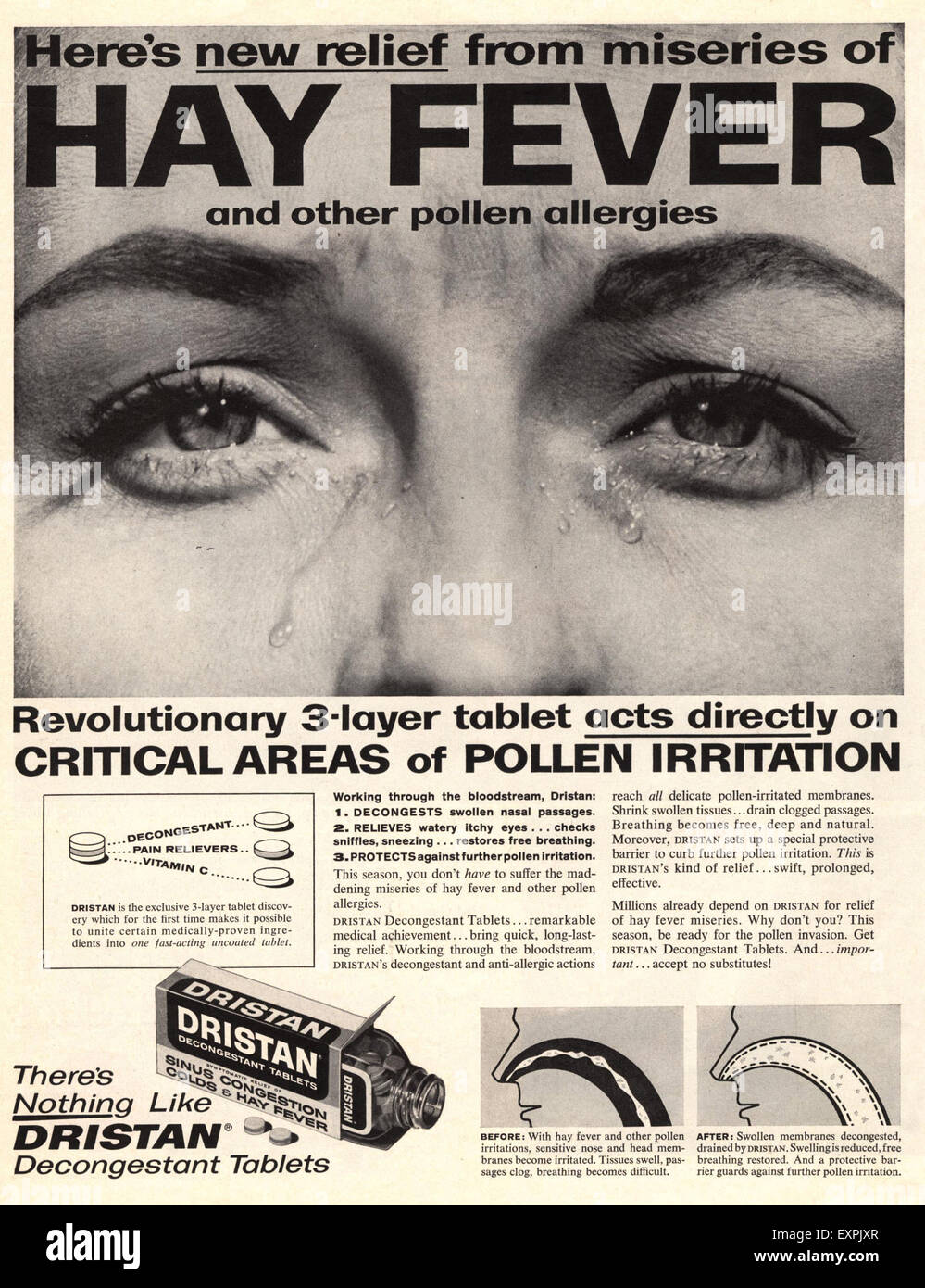 Anni sessanta USA Dristan Magazine annuncio pubblicitario Foto Stock
