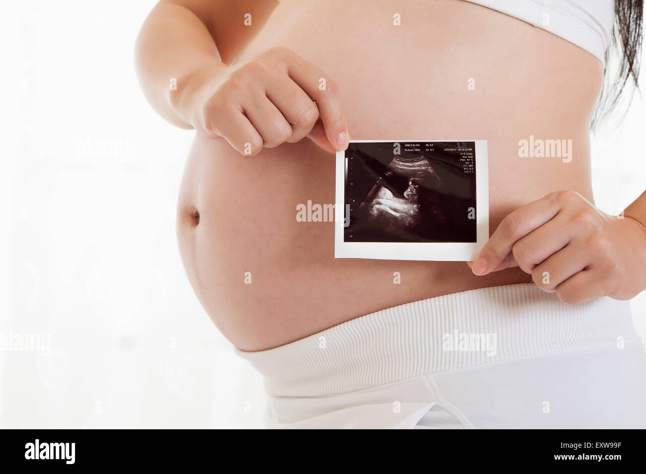 Donna incinta azienda immagine a raggi X sull'addome, Foto Stock