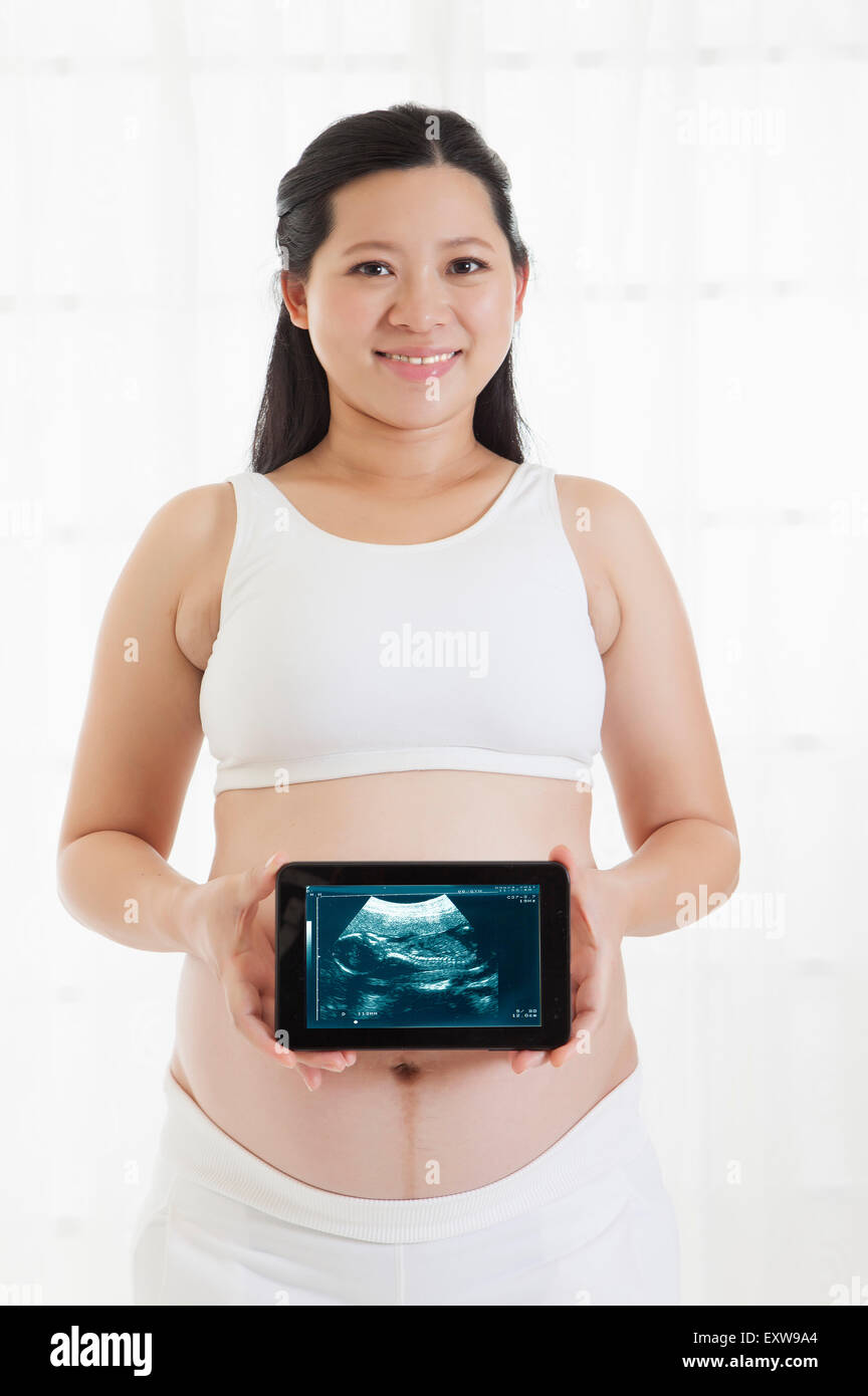 Donna incinta tenendo premuto il touch pad con immagine a raggi X e sorridente alla telecamera, Foto Stock