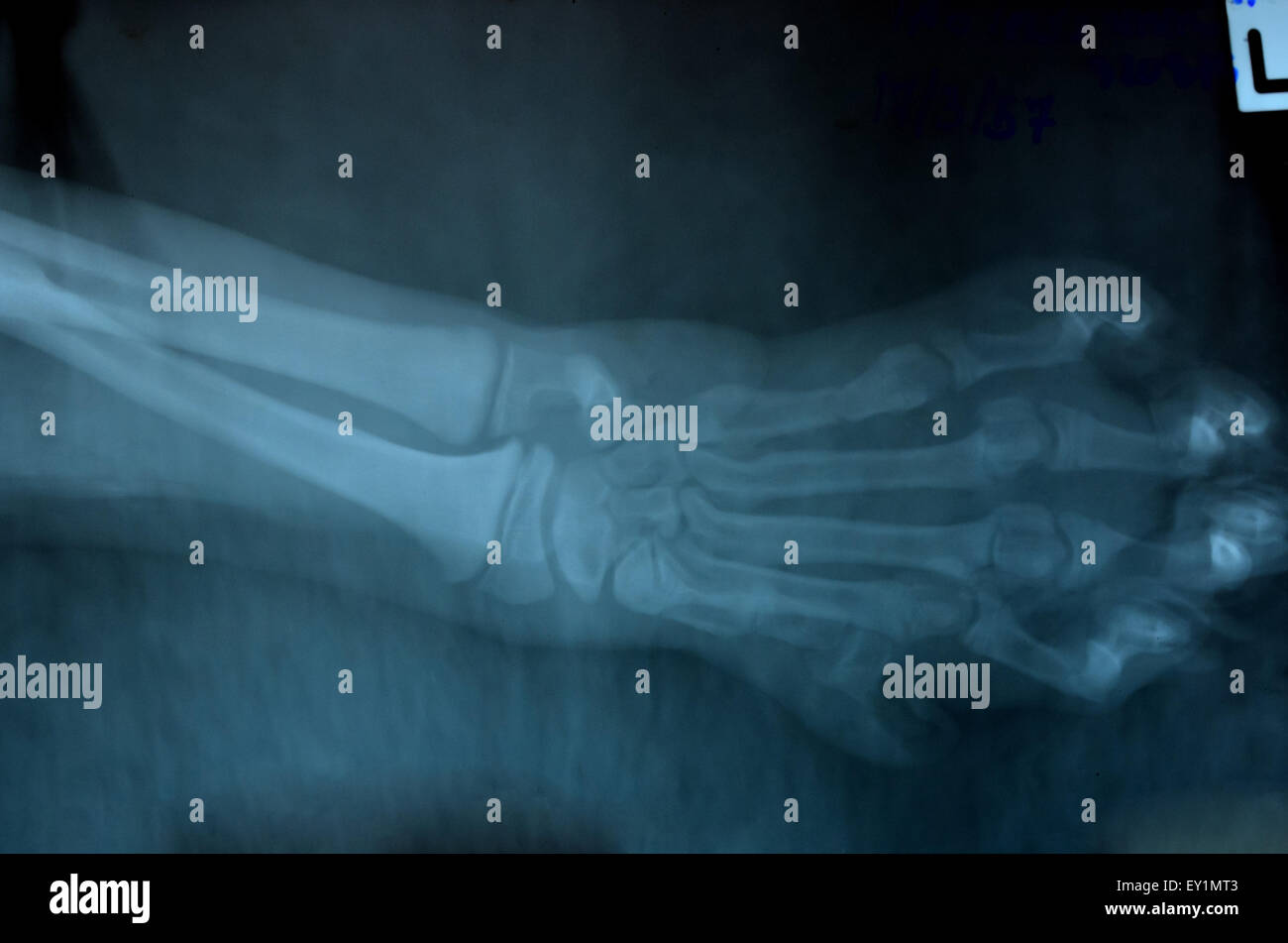 X ray foto di animale selvatico scheletro Foto Stock