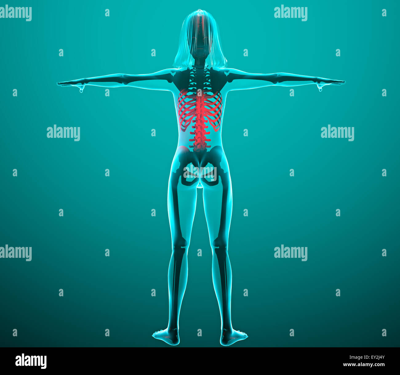 3d umani x-ray con dolore nella colonna vertebrale e nervature Foto Stock