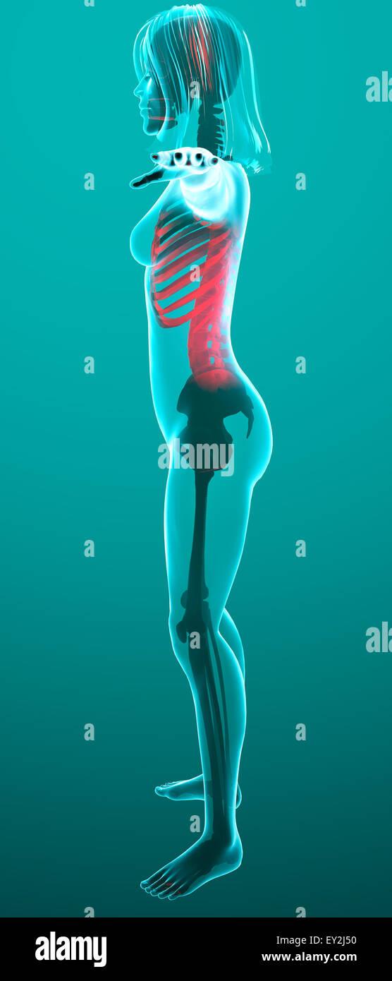 Human x-ray con dolore nella colonna vertebrale e nervature Foto Stock