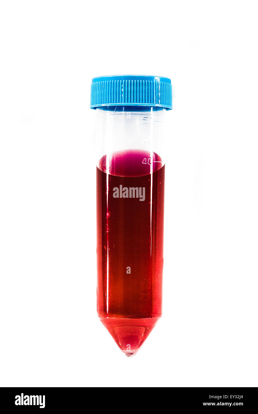 Provetta di sangue Foto Stock
