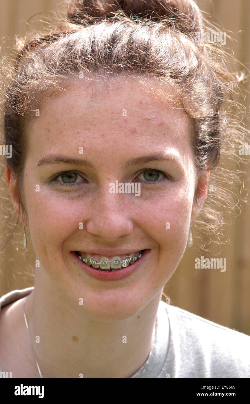 Ritratto di ragazza adolescente con bretelle sorridente Foto Stock