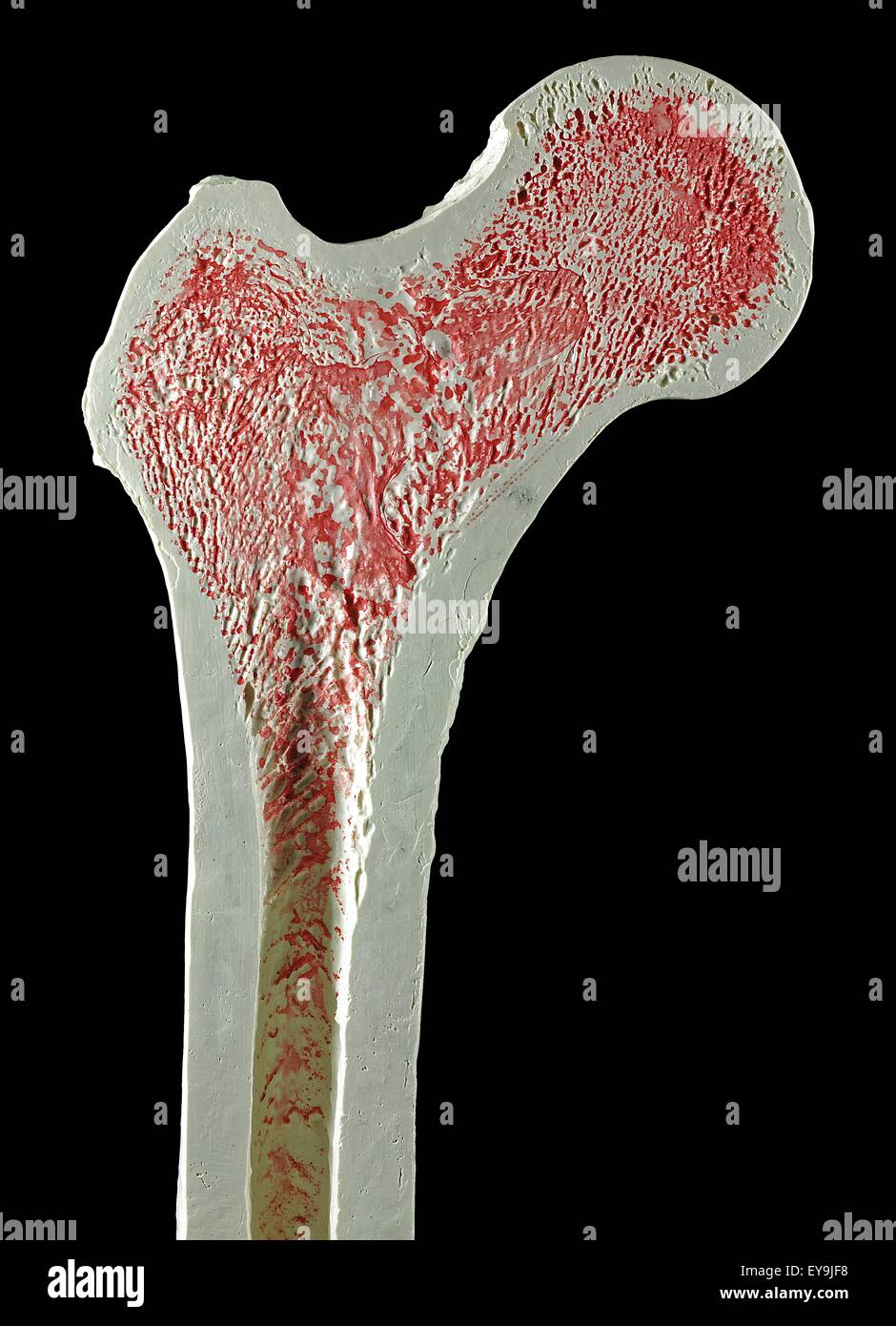 Sezione trasversale attraverso un modello di un normale destra superiore del femore gamba o osso. Foto Stock