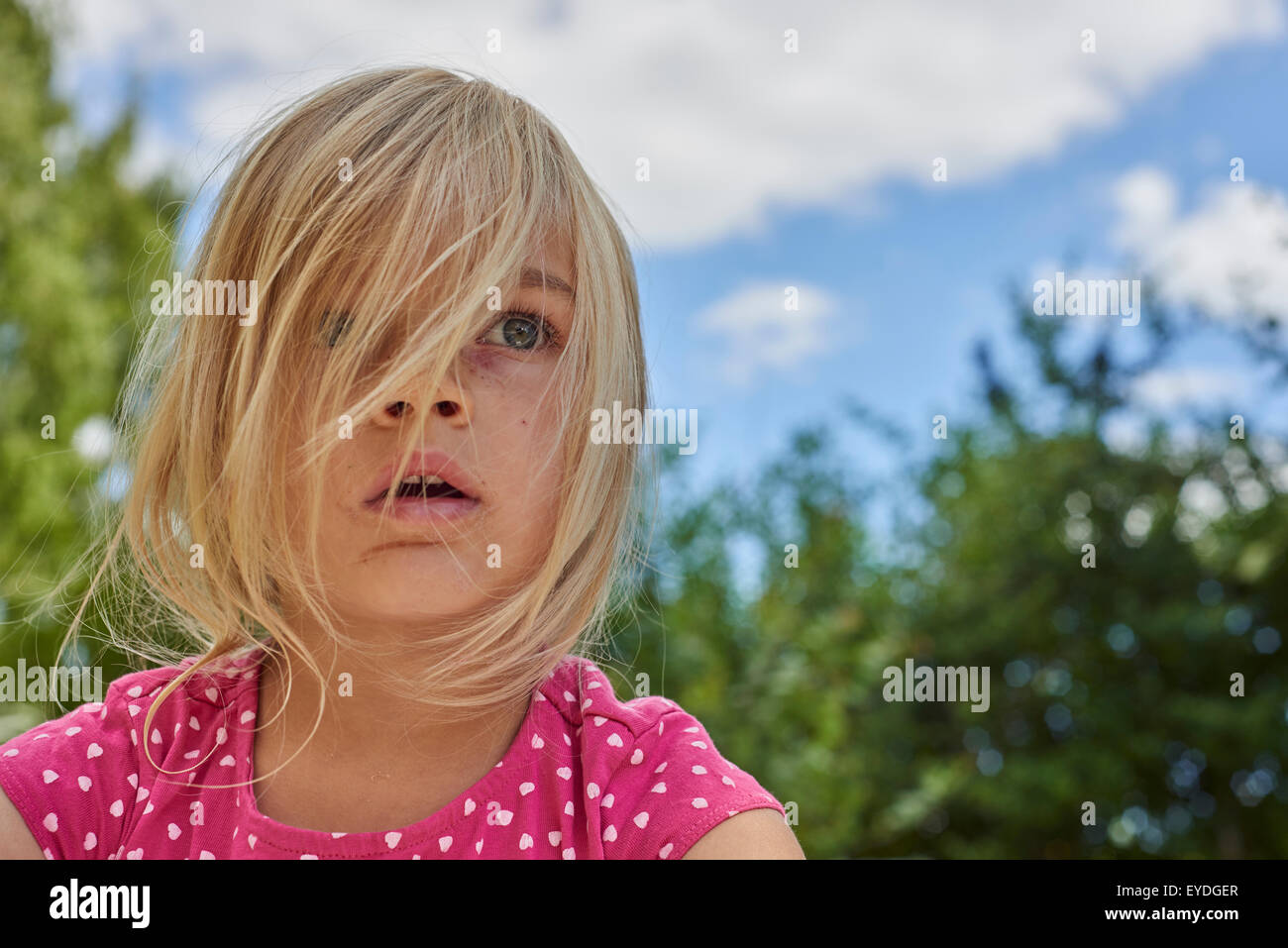 Ritratto di stupito, sconvolto, sorpreso bambino ragazza bionda al di fuori, estate, backyard, parco, giardino con alberi sullo sfondo Foto Stock