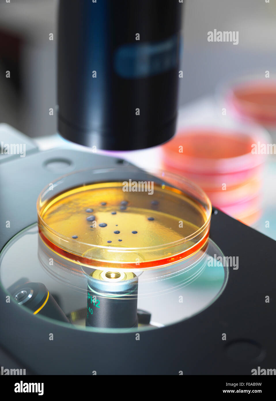 Piastre Petri contenenti coltura batterica in esame con microscopio a luce invertita nel laboratorio di microbiologia Foto Stock