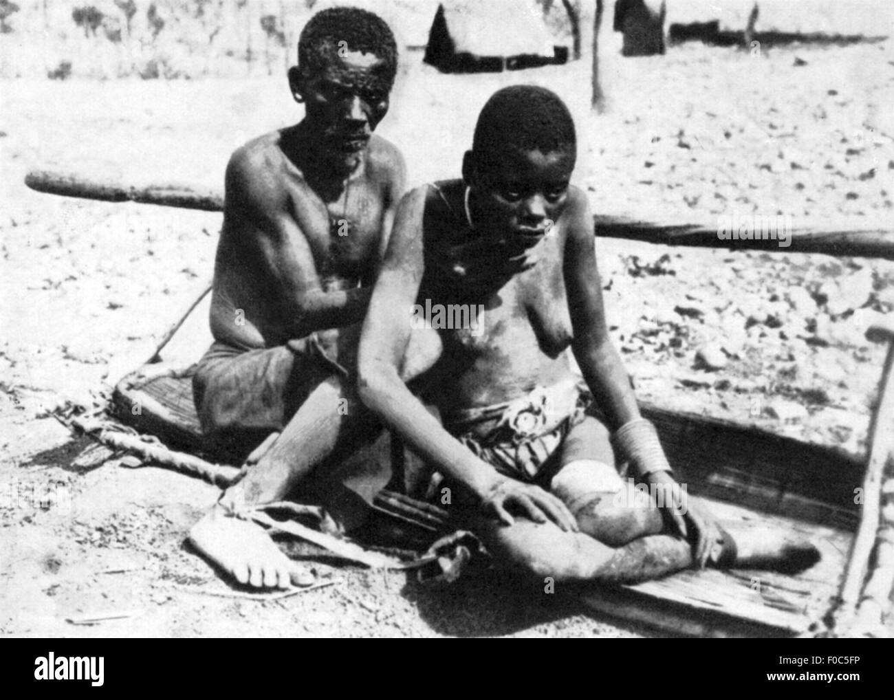 Medicina, malattia, malattia del sonno, donna prima del trattamento, Lago Victoria, circa 1906, diritti aggiuntivi-clearences-non disponibile Foto Stock