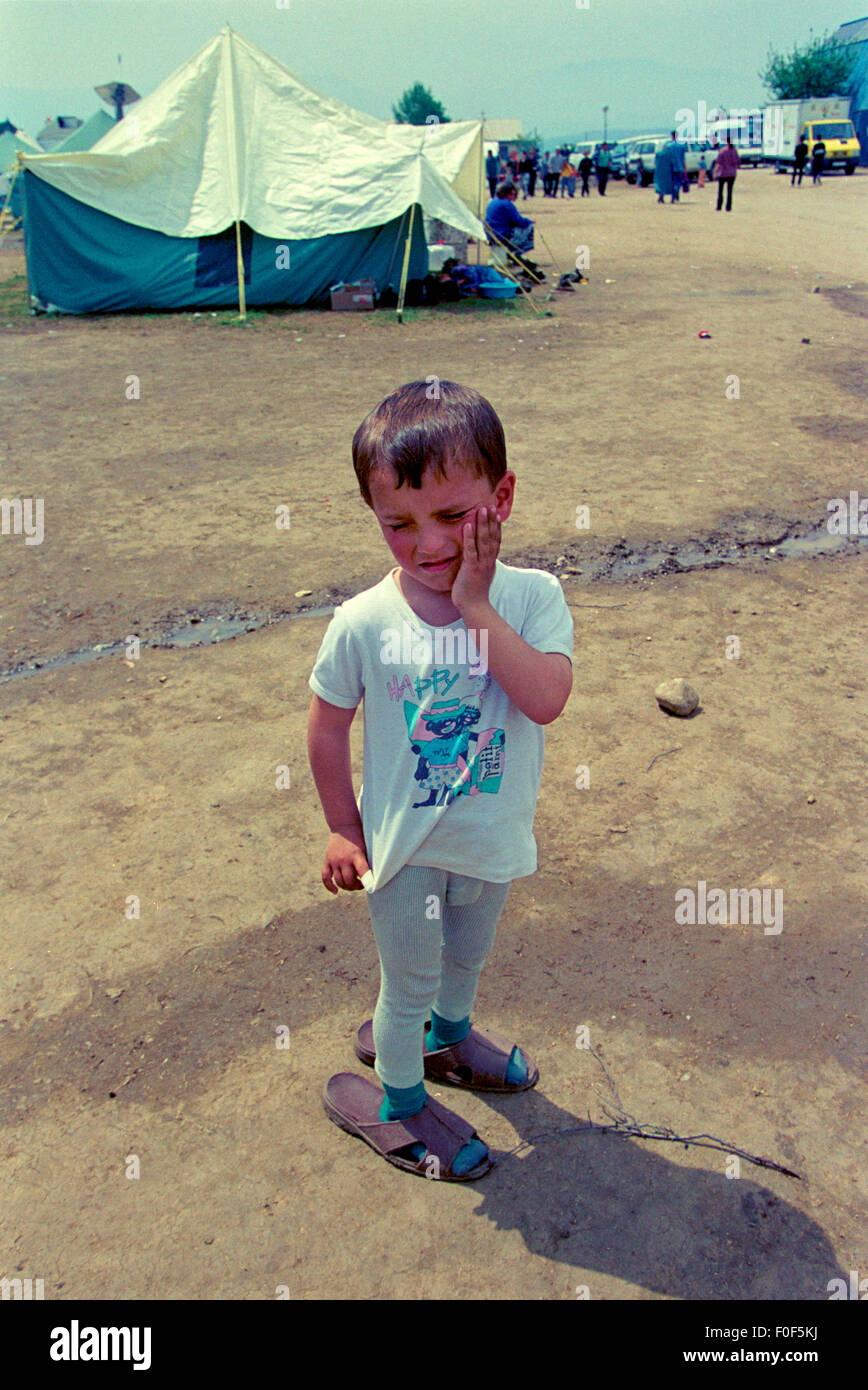 Profughi kosovari a camp Strankovic Macedonia 1999 .. un ragazzo giovane triste chiedendo intorno al campo .. molti bambini ha perso i genitori durante il conflitto Foto Stock