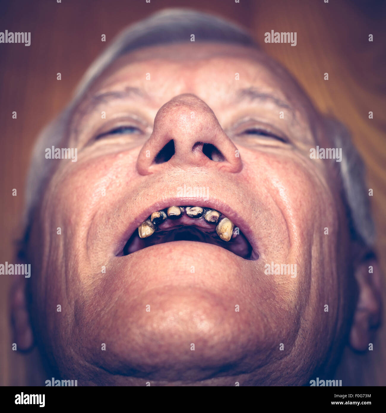 Primo piano di un vecchio uomo faccia con denti di brutto. Foto Stock