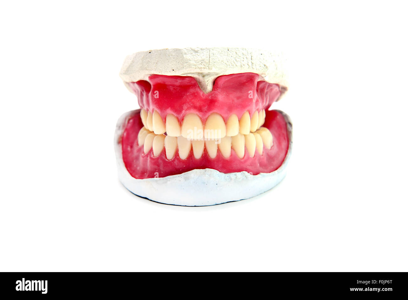 Cera umana denti dentale stampo isolato su bianco Foto Stock