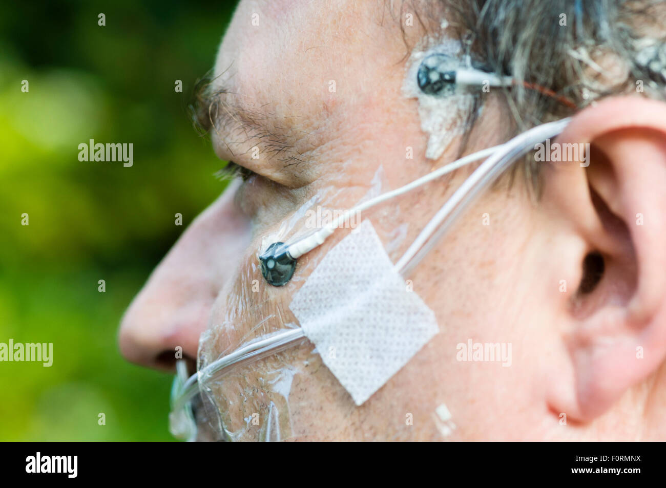 Un uomo di mezza età indossa gli elettrodi di polisonnografia per misurare l'attività cerebrale, la respirazione e il movimento durante il sonno. Foto Stock
