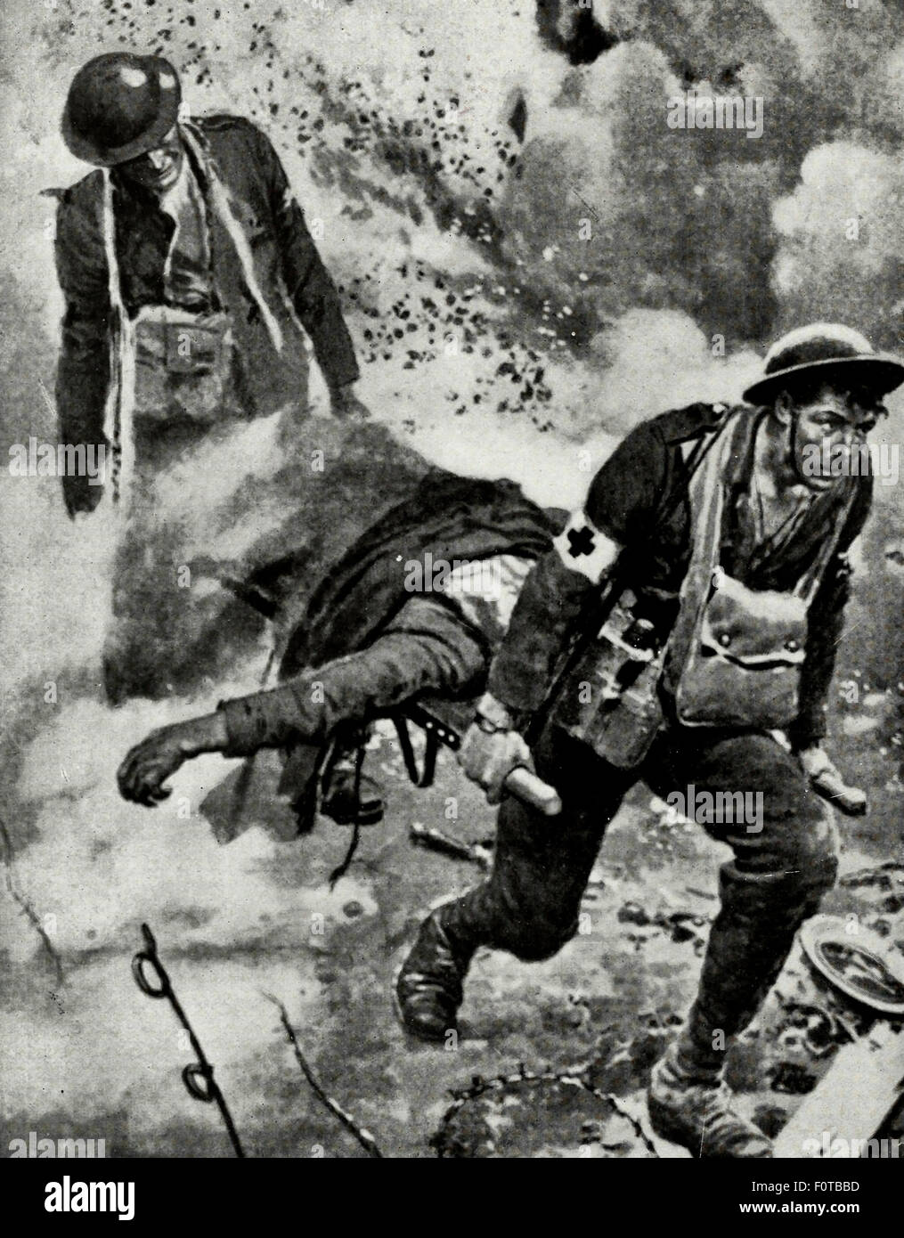 Barellieri portare feriti sotto il fuoco nemico da durante la Prima Guerra Mondiale Foto Stock