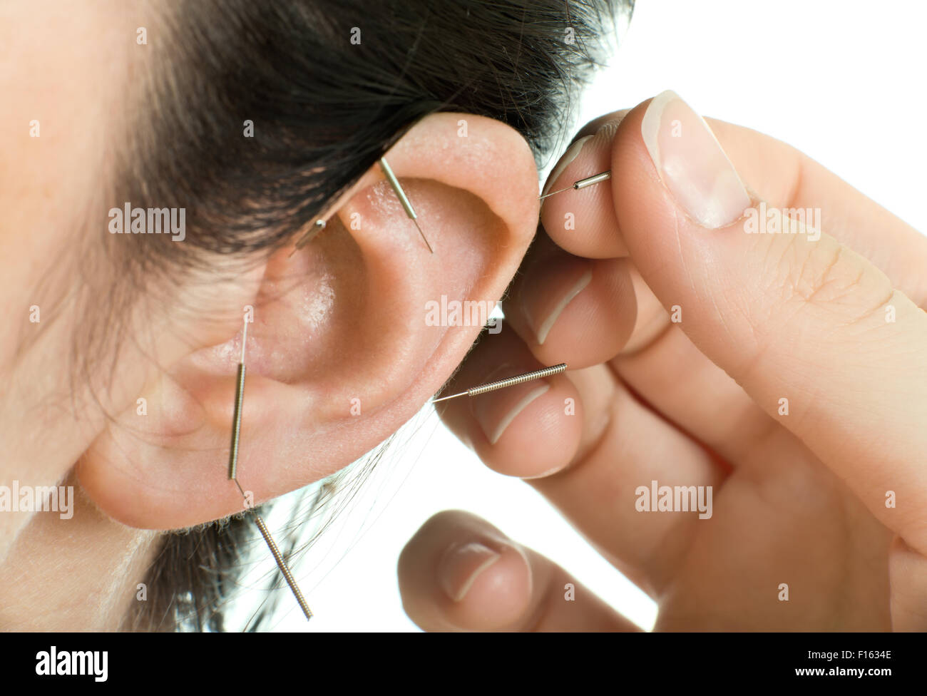 La terapia di agopuntura sul padiglione auricolare, orizzontale molto vicino fino foto Foto Stock