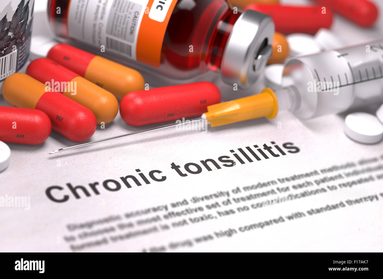 Tonsillite cronica - Diagnosi stampate con Red pillole, iniezioni e la siringa. Concetto medico con il fuoco selettivo. Foto Stock