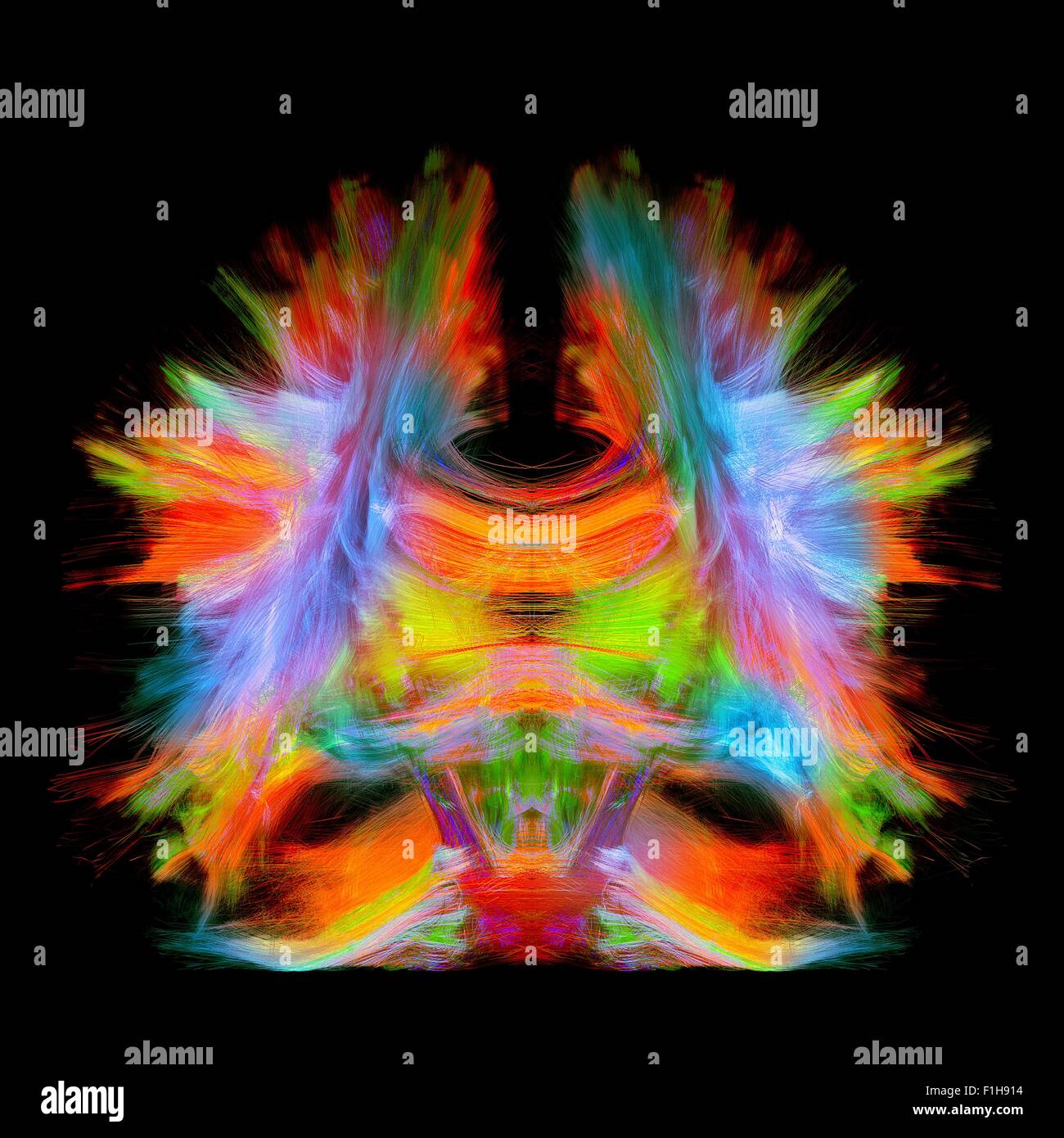 Piena di cervello artistico tractography colore. Questa è piena di tracciamento del cervello proveniente da super-risoluzione ricostruzione 0,6 mm cubi. vista. Foto Stock