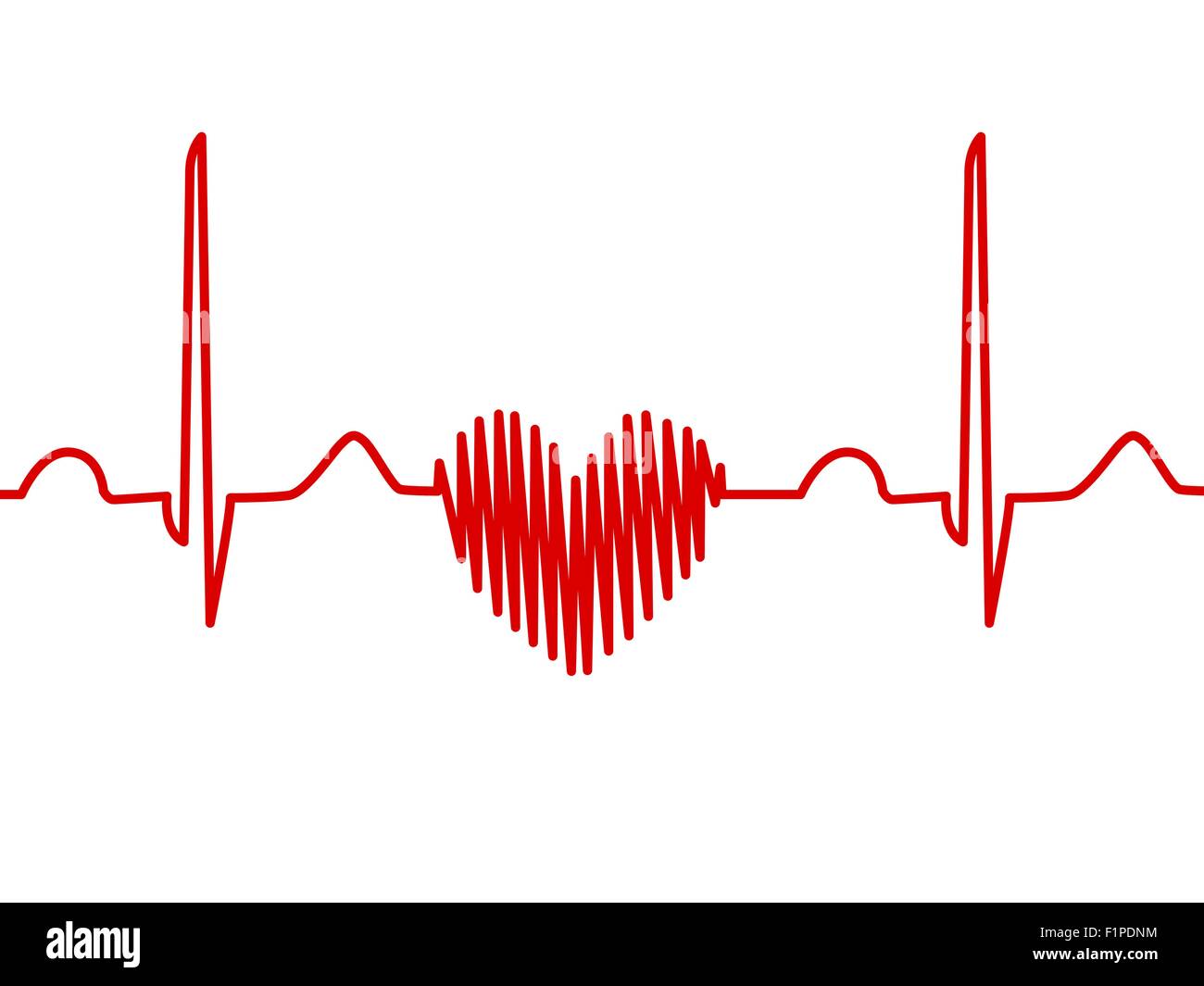 Computer illustrazione di una forma di cuore elettrocardiogramma (ECG) traccia. Un ECG misura l'attività elettrica del cuore. Foto Stock