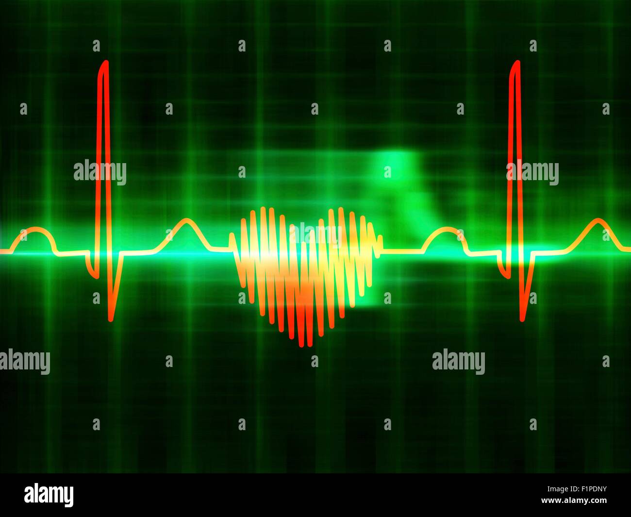 Computer illustrazione di una forma di cuore elettrocardiogramma (ECG) traccia. Un ECG misura l'attività elettrica del cuore. Foto Stock