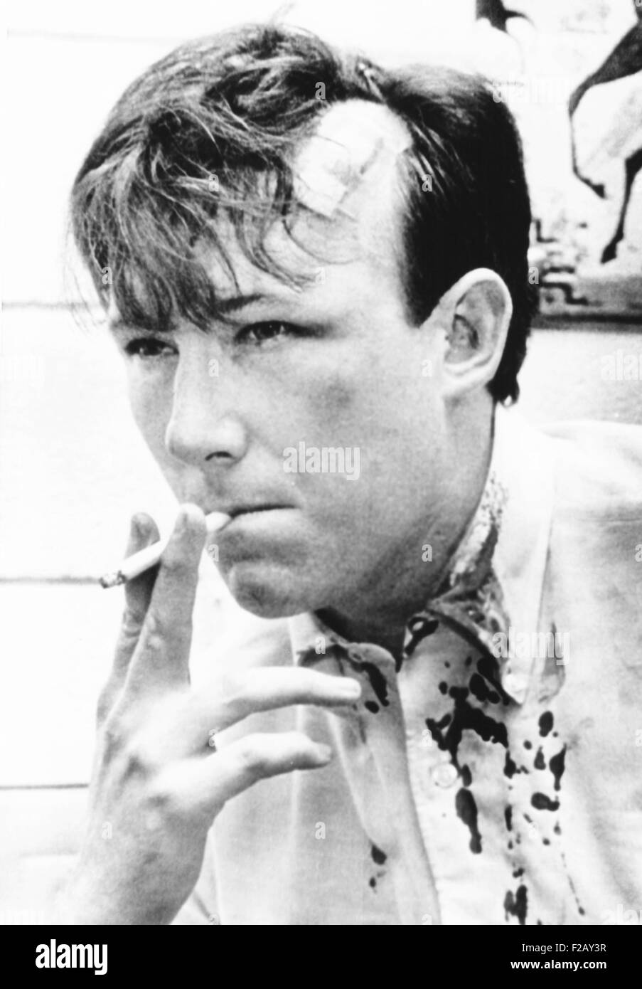 Washington Post reporter Jim Hoagland è stato picchiato a South Carolina State College. Feb.10, 1968. Due giorni prima, Carolina del Sud autostrada Patrol Officers shot in una folla di manifestanti vicino al nero storicamente college. Tre studenti sono stati uccisi e 28 feriti nella 'Orangeburg massacro" la sera del 8 febbraio 1968. (CSU 2015 9 878) Foto Stock