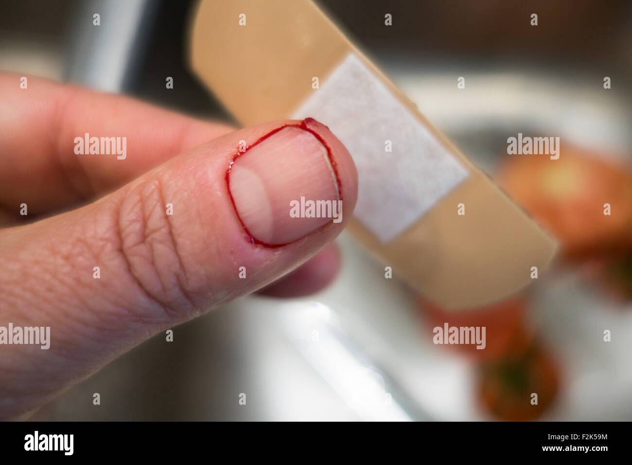 Un pollice che è stato tagliato con il sangue che circonda la miniatura con un bendaggio. Foto Stock