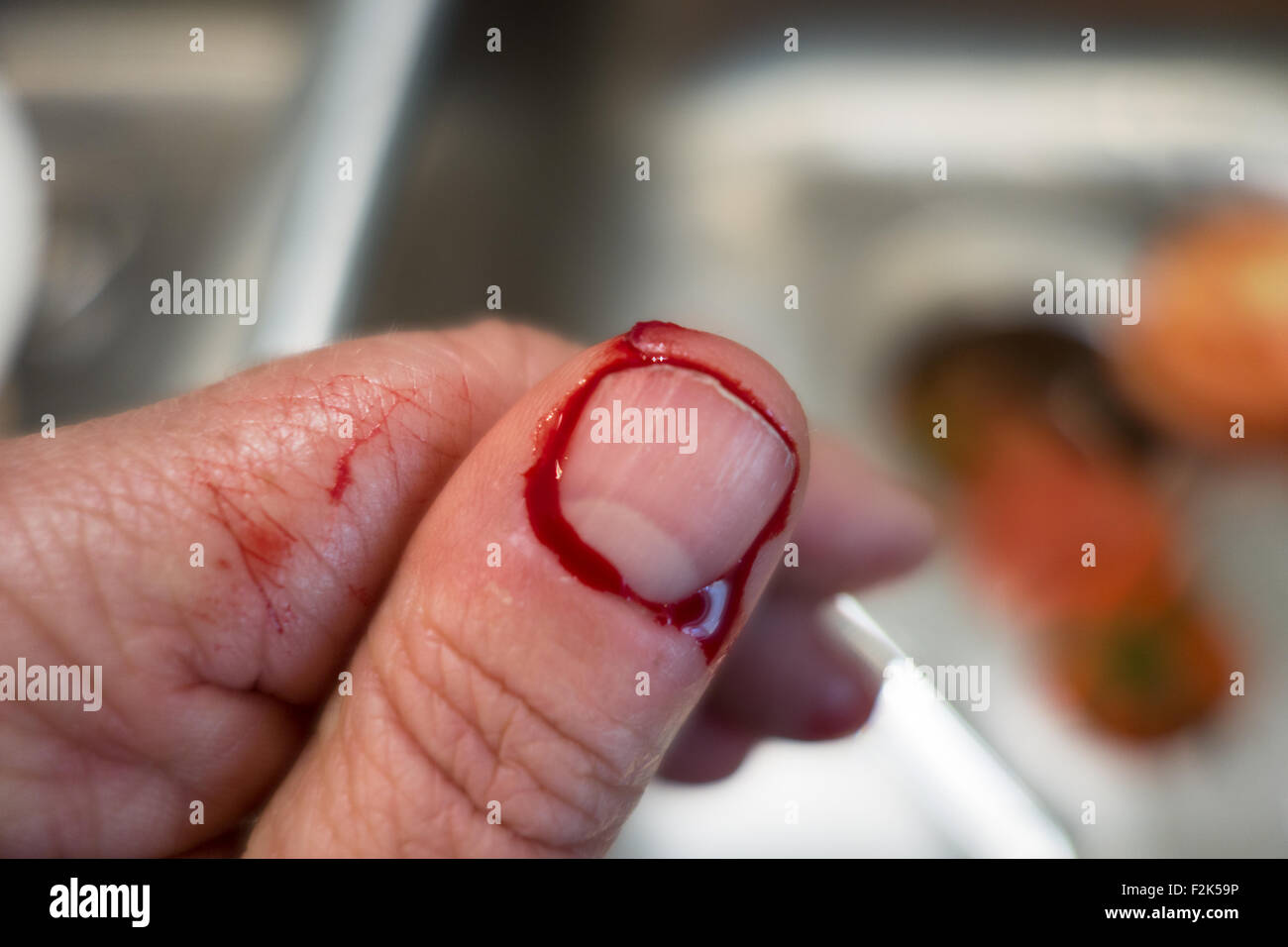 Un pollice che è stato tagliato con il sangue che circonda la miniatura. Foto Stock