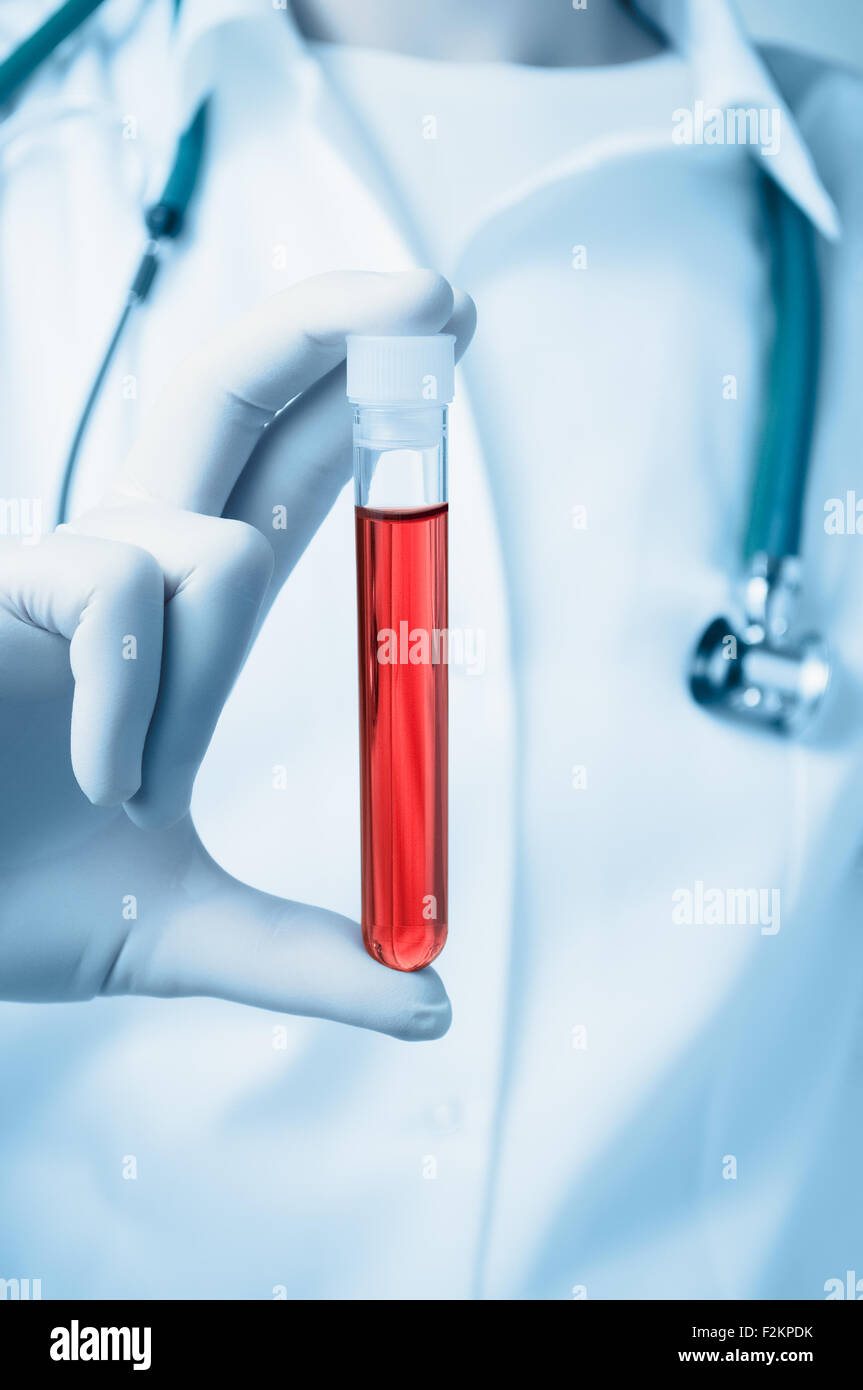 Medico tenendo una bottiglia di campione di sangue Foto Stock