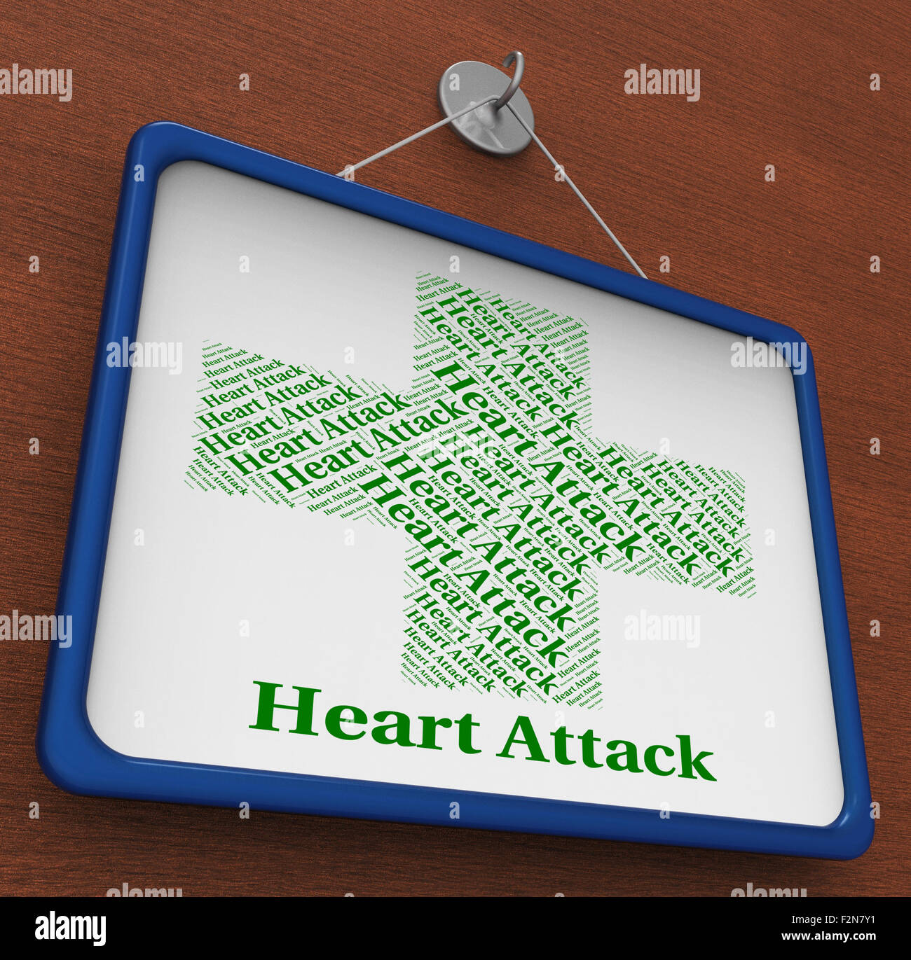 Attacco di cuore in rappresentanza di infarto miocardico acuto e arresto cardiaco Foto Stock