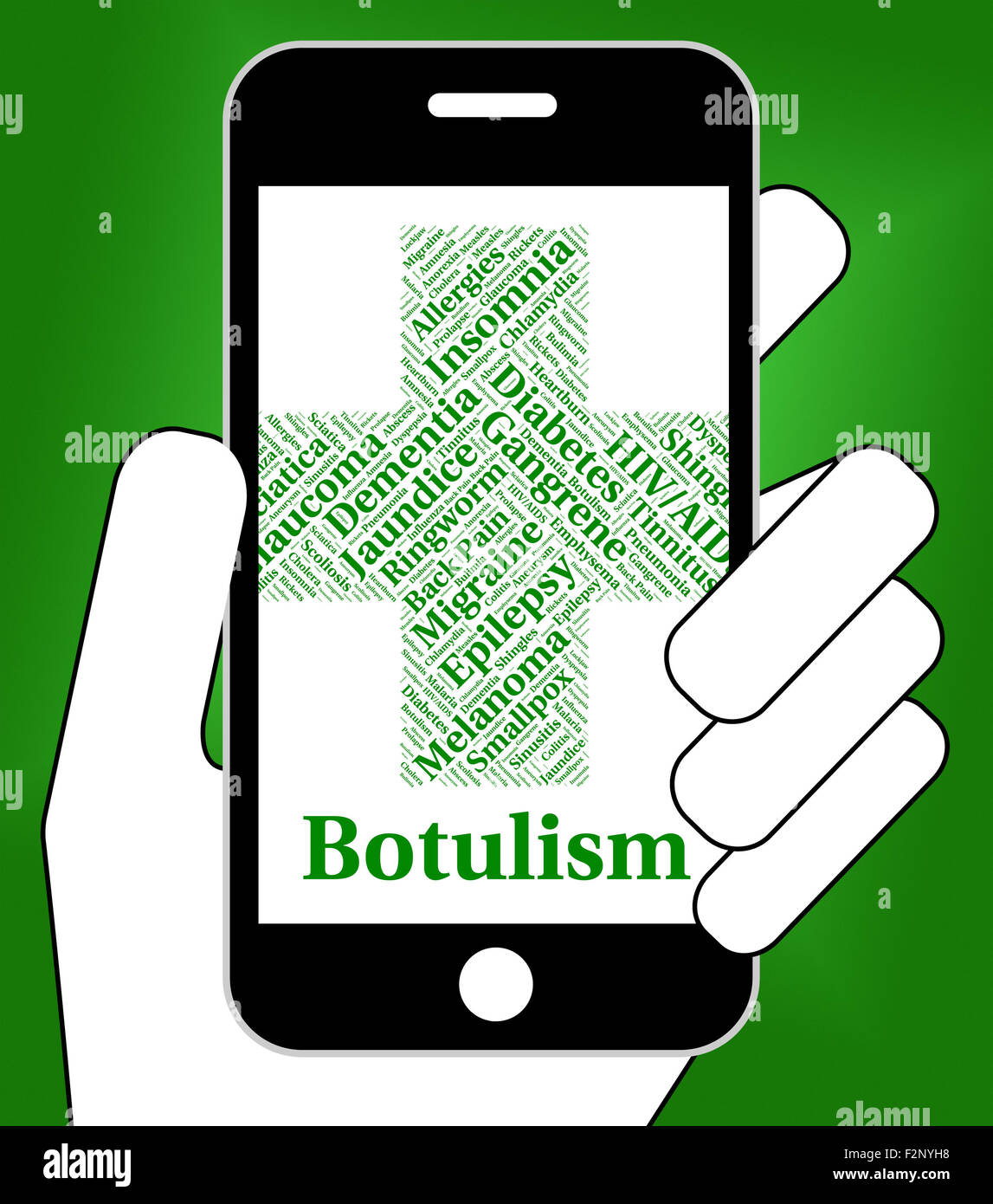 Botulismo malattia in rappresentanza di avvelenamento alimentare e contagio Foto Stock