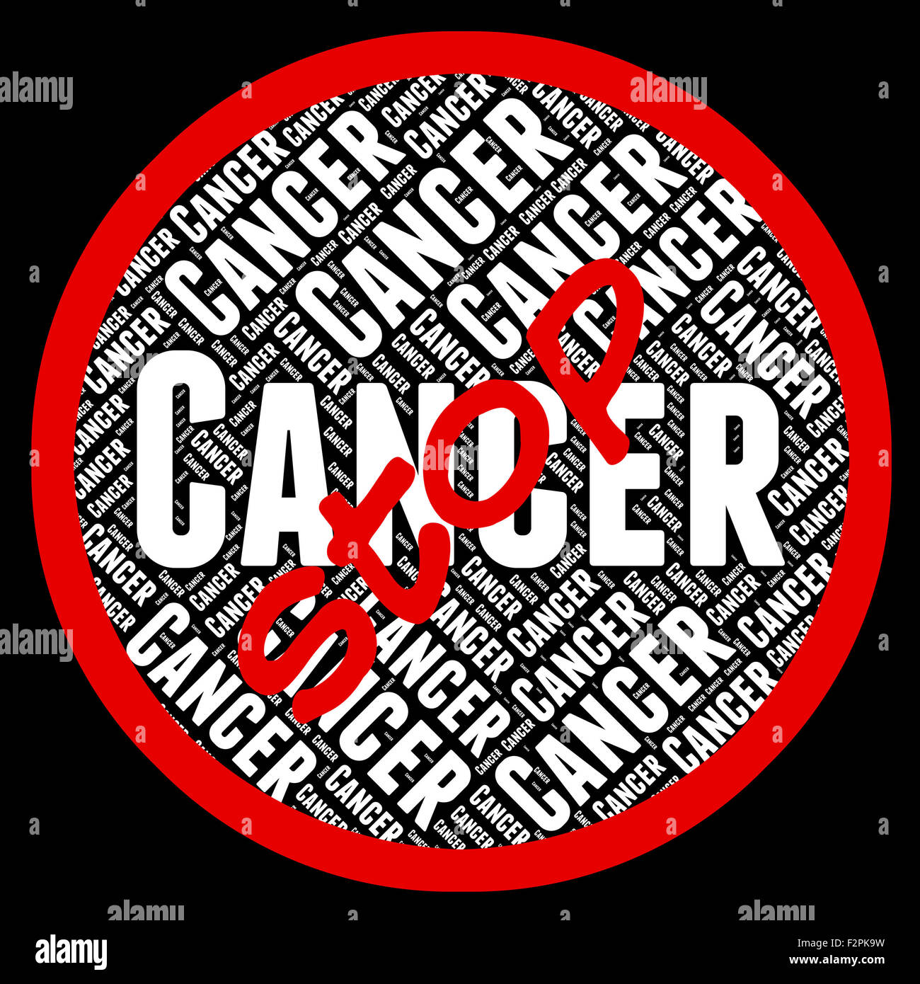 Arrestare il cancro che mostra la crescita maligna e tumori Foto Stock