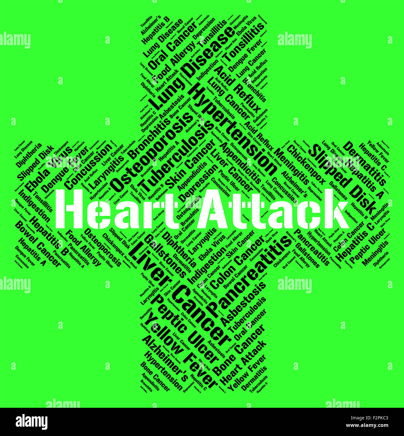 Attacco di cuore in rappresentanza di infarto miocardico acuto e di infarto miocardico acuto Foto Stock