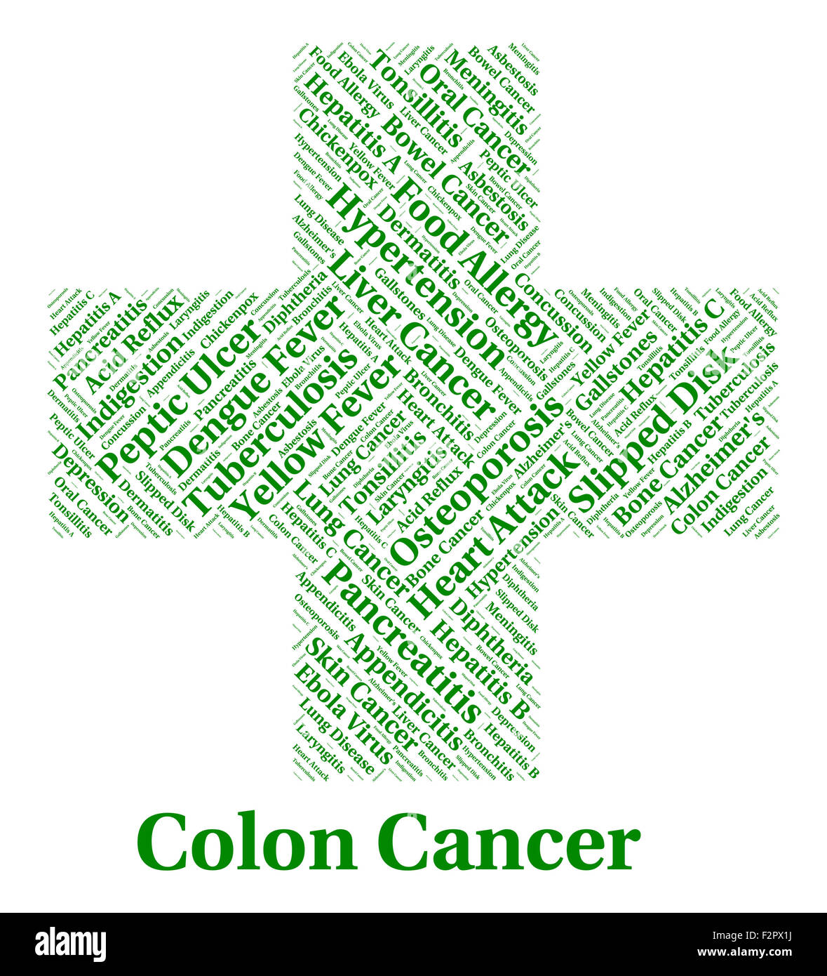 Il cancro del colon che mostra la cattiva salute e malignità Foto Stock