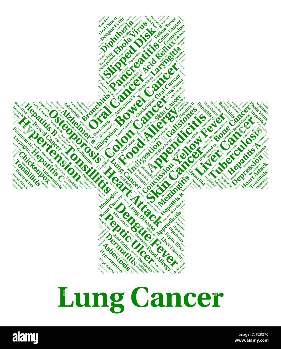 Il cancro del polmone che mostra crescita cancerosa e denuncia Foto Stock