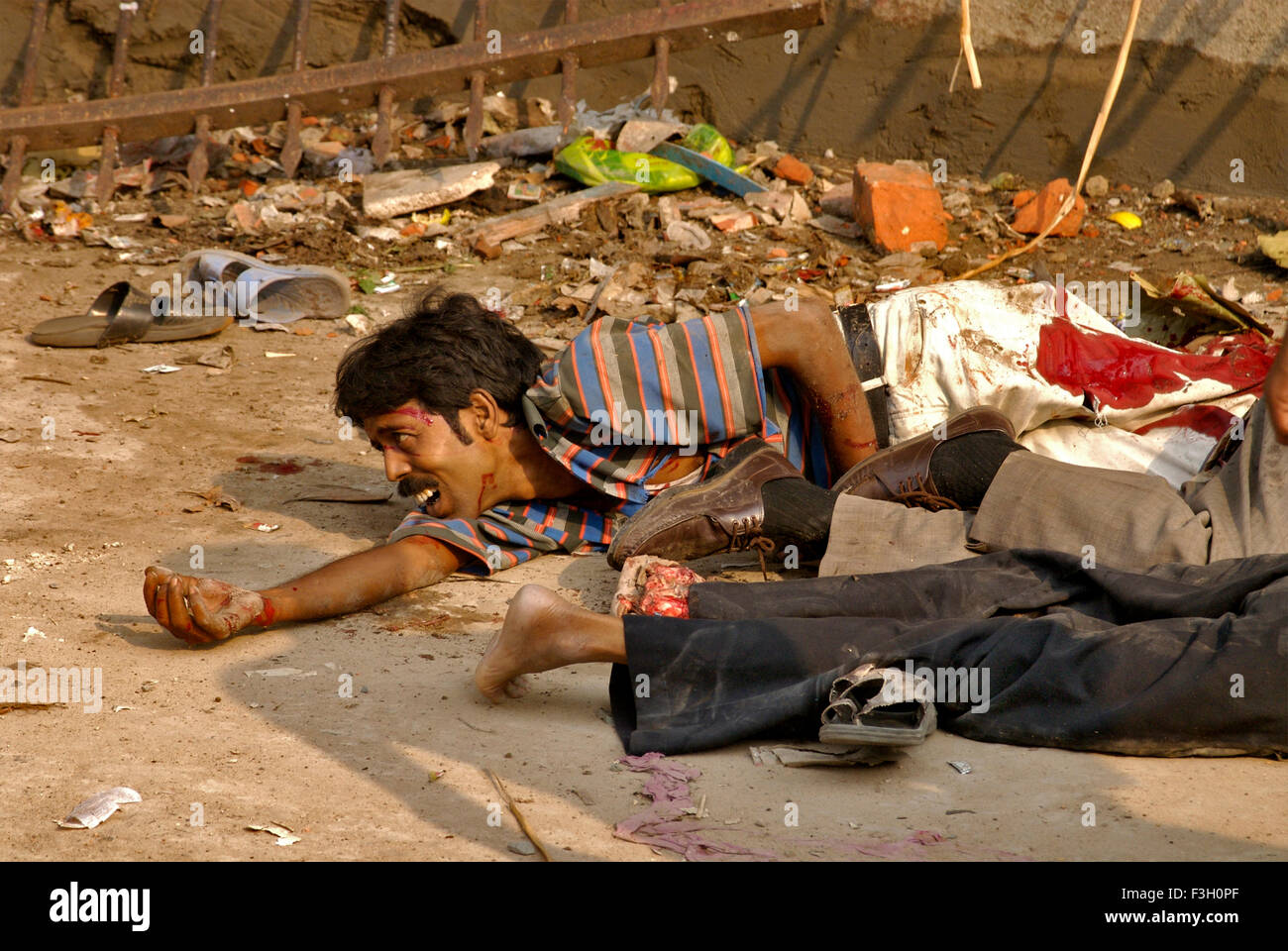 Uomo disteso feriti a quella di Howrah ; Calcutta ; Bengala Occidentale ; India Foto Stock