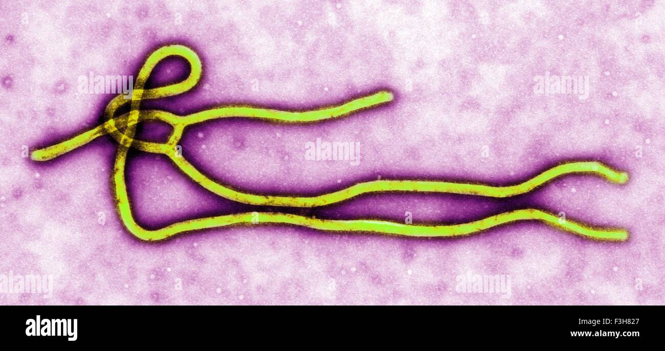 Microscopio elettronico a trasmissione (TEM) di un virus Ebola virione Foto Stock