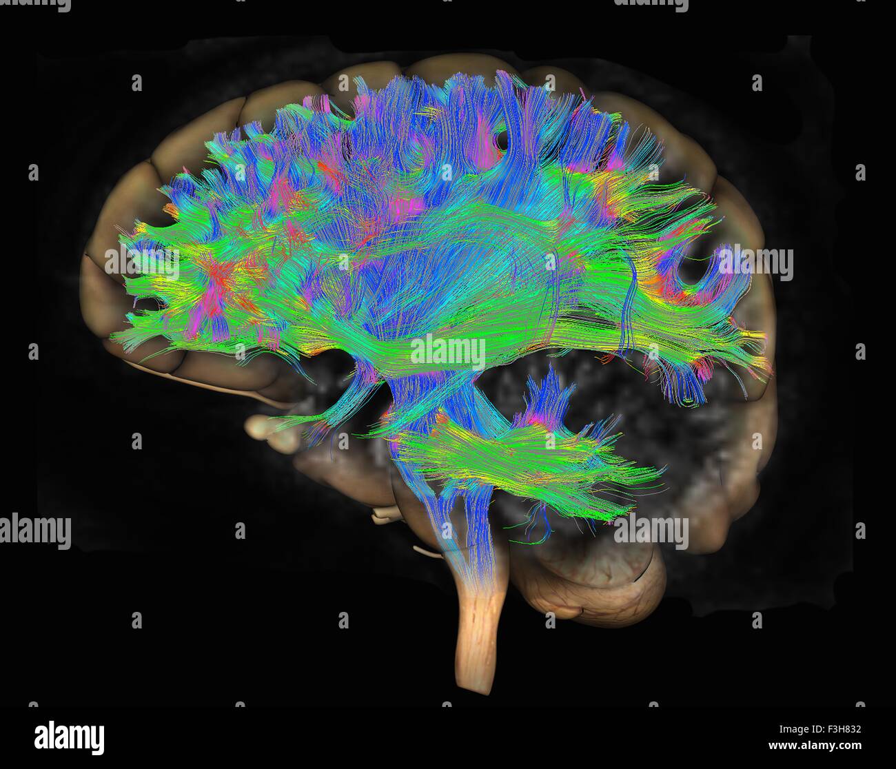 La diffusione MRI, a cui si fa riferimento anche come imaging del tensore di diffusione o DTI, del cervello umano Foto Stock