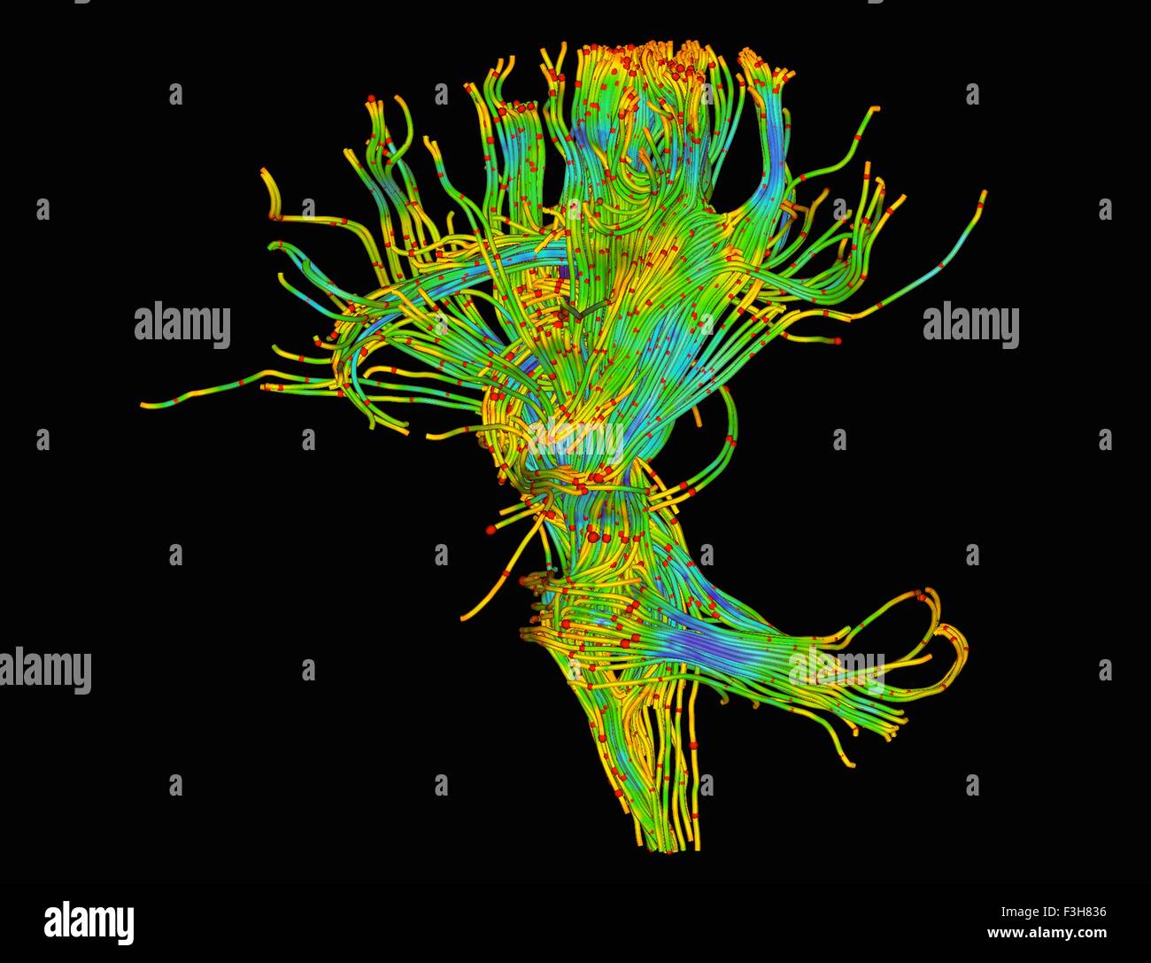 La diffusione MRI, a cui si fa riferimento anche come imaging del tensore di diffusione o DTI, del cervello umano Foto Stock