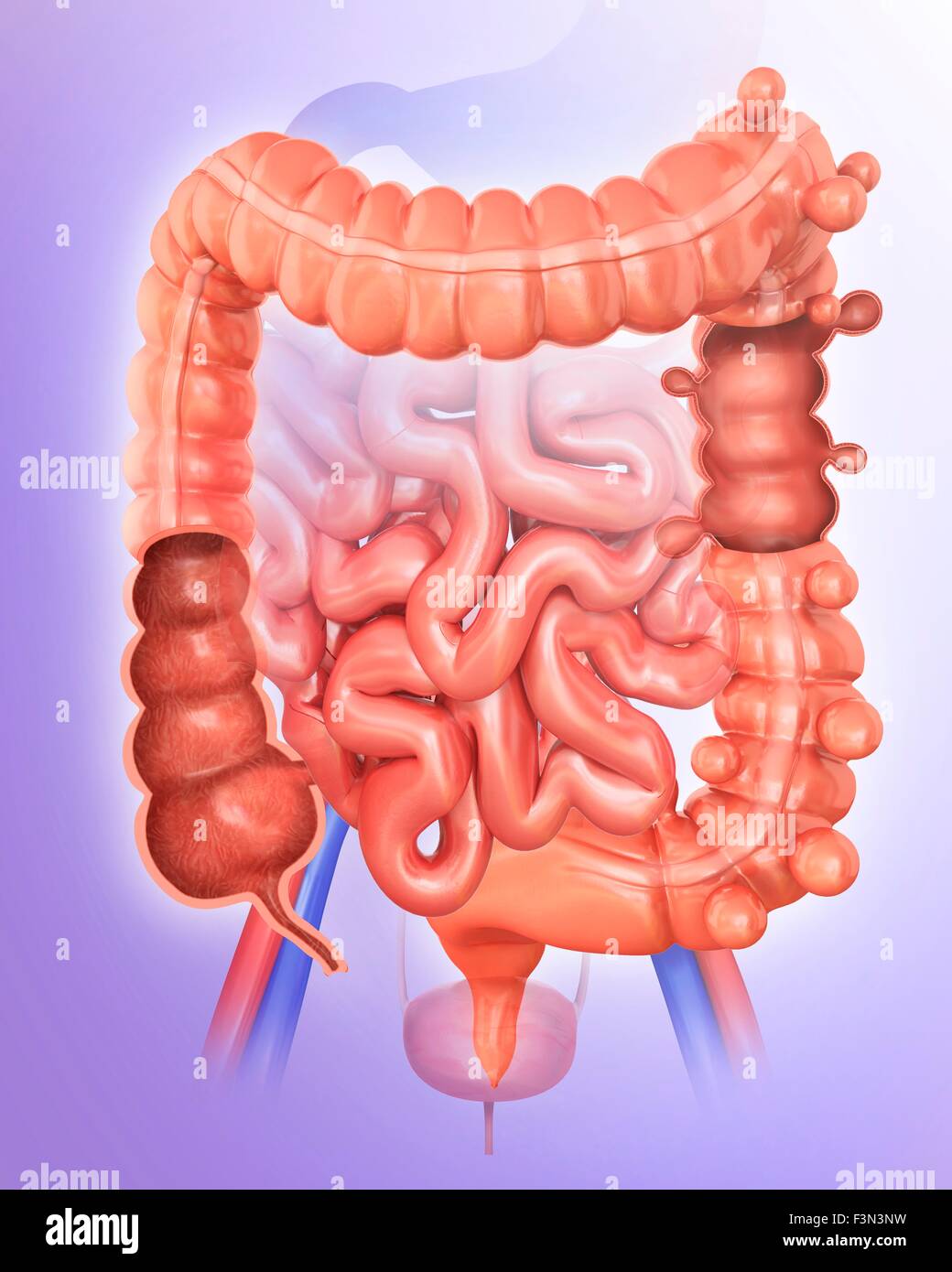 Diverticolosi, illustrazione Foto Stock