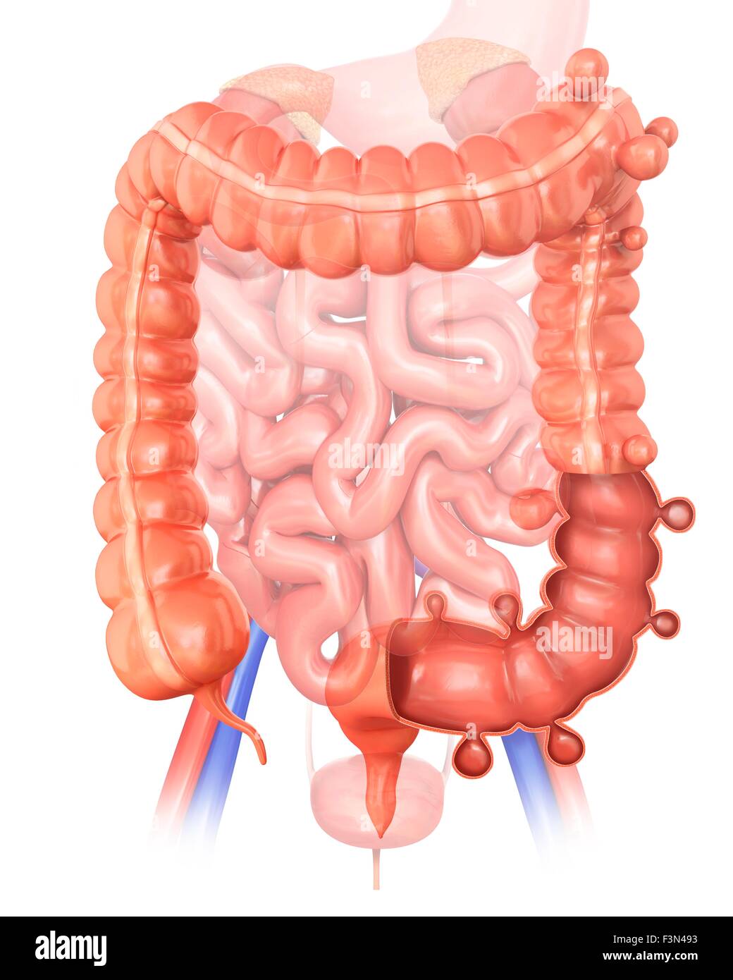 Diverticolosi, illustrazione Foto Stock