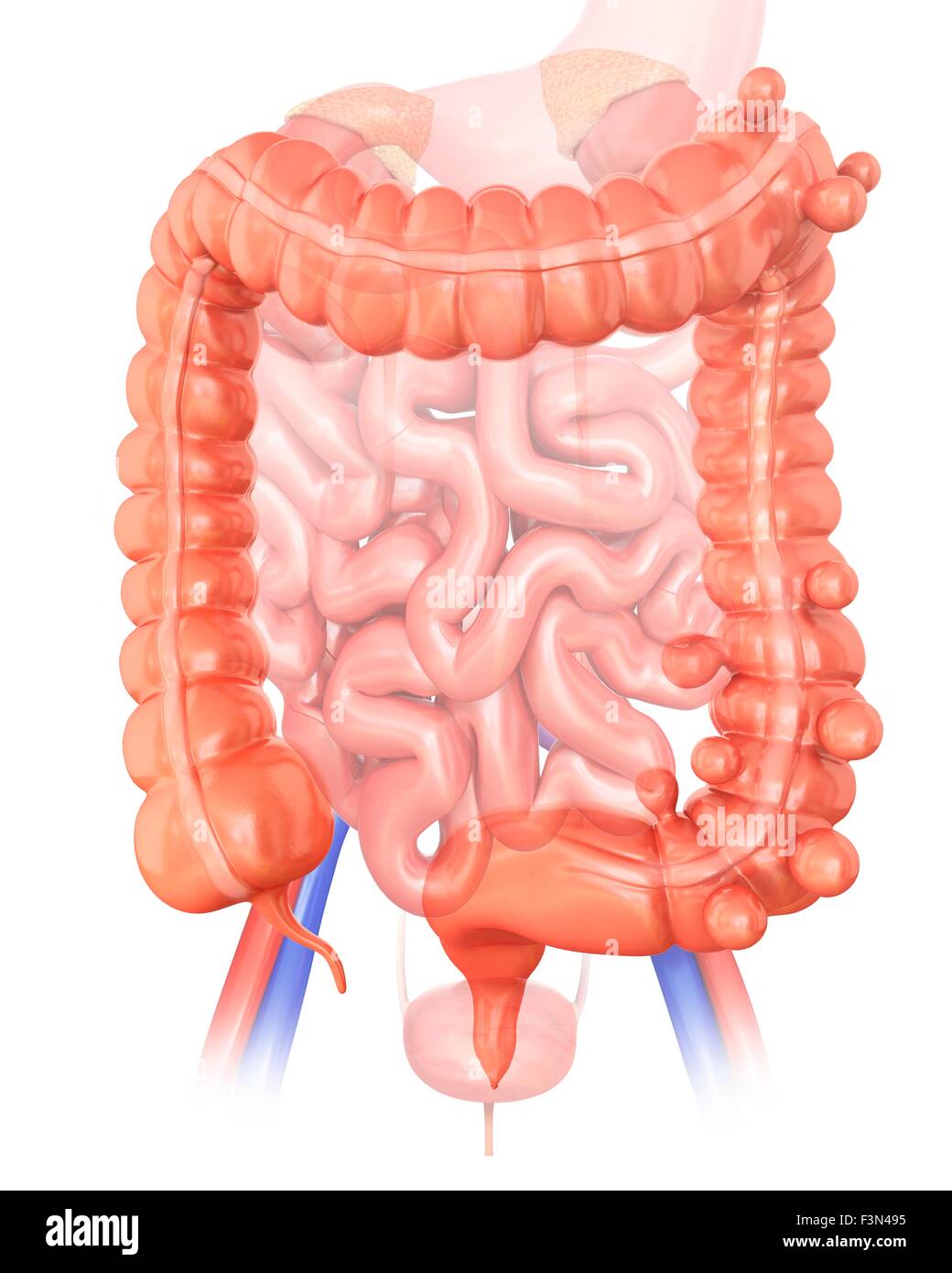 Diverticolosi, illustrazione Foto Stock