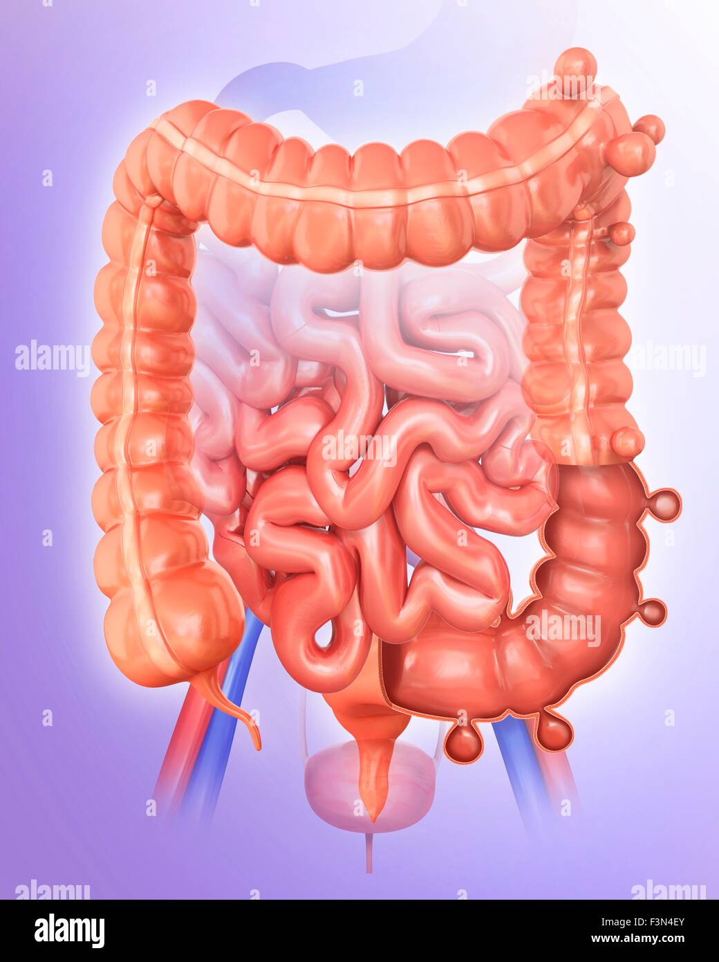 Diverticolosi, illustrazione Foto Stock