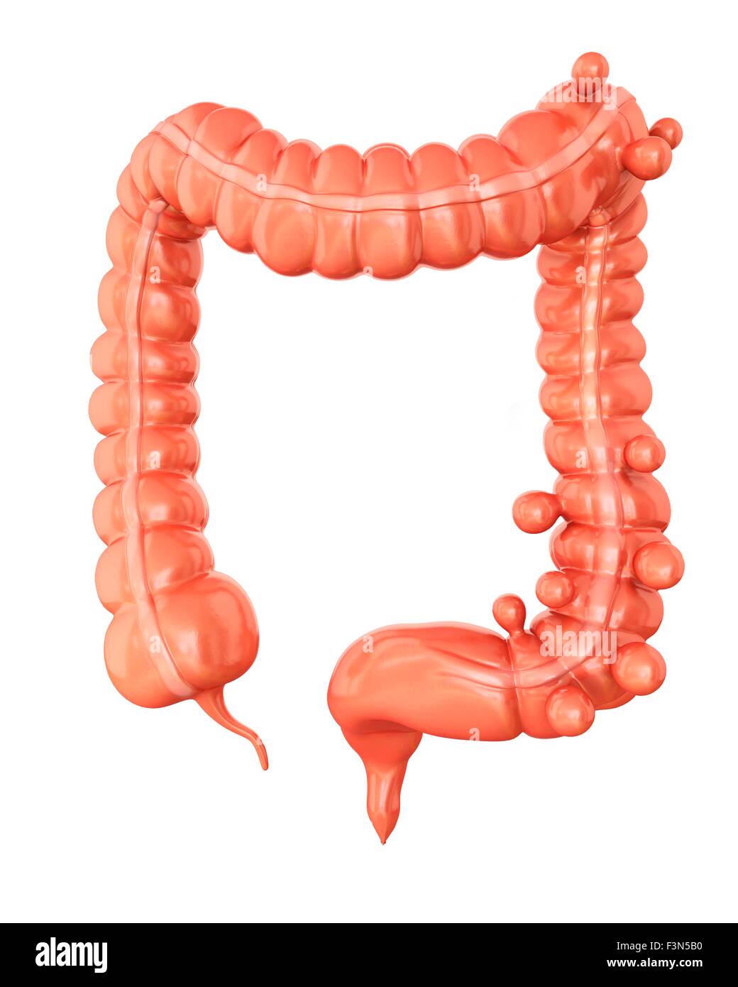 Diverticolosi, illustrazione Foto Stock